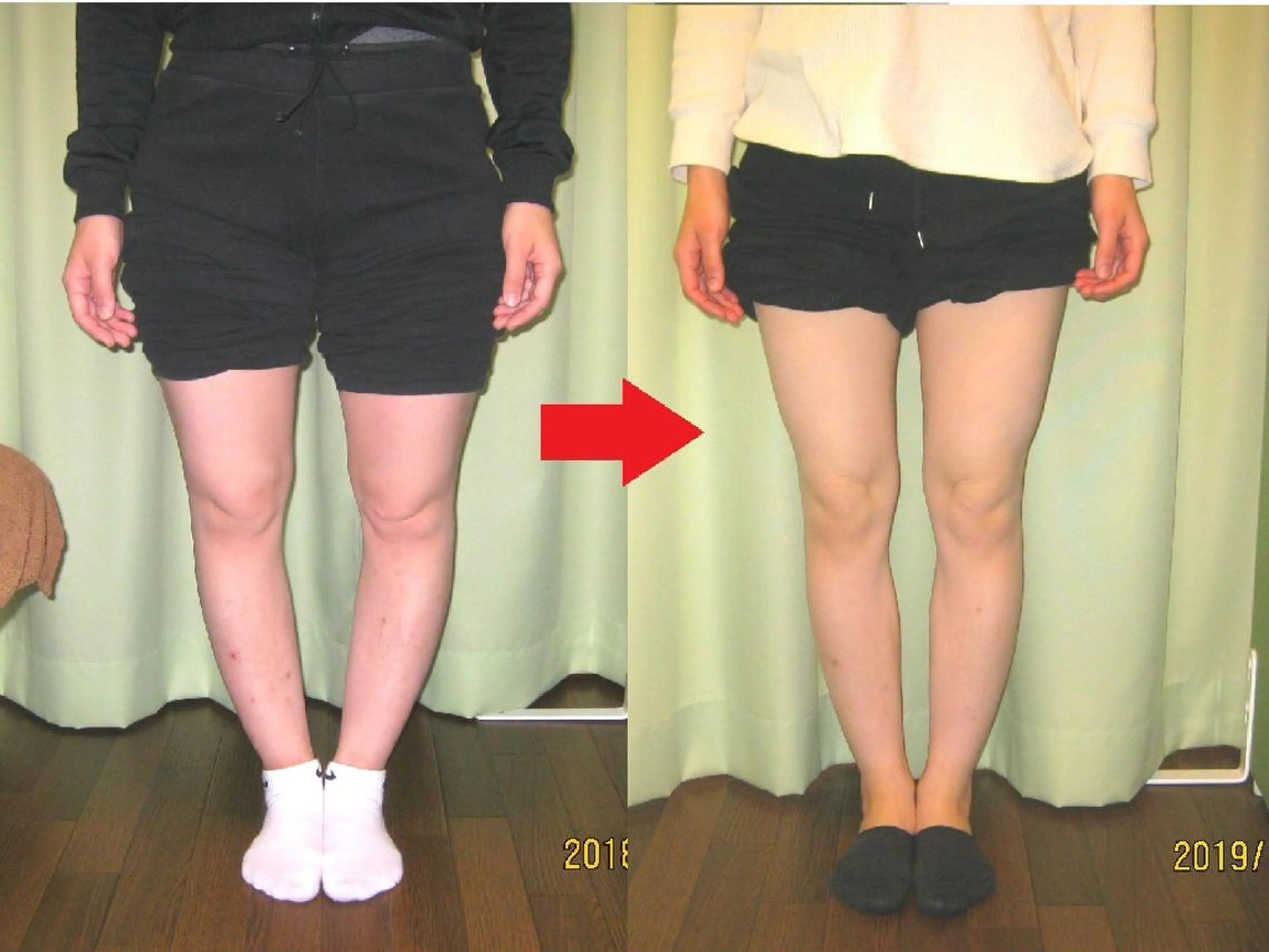 ゆがみ専門整体♪骨盤 姿勢 美脚✨清水貞利のエステ・リラクイメージ