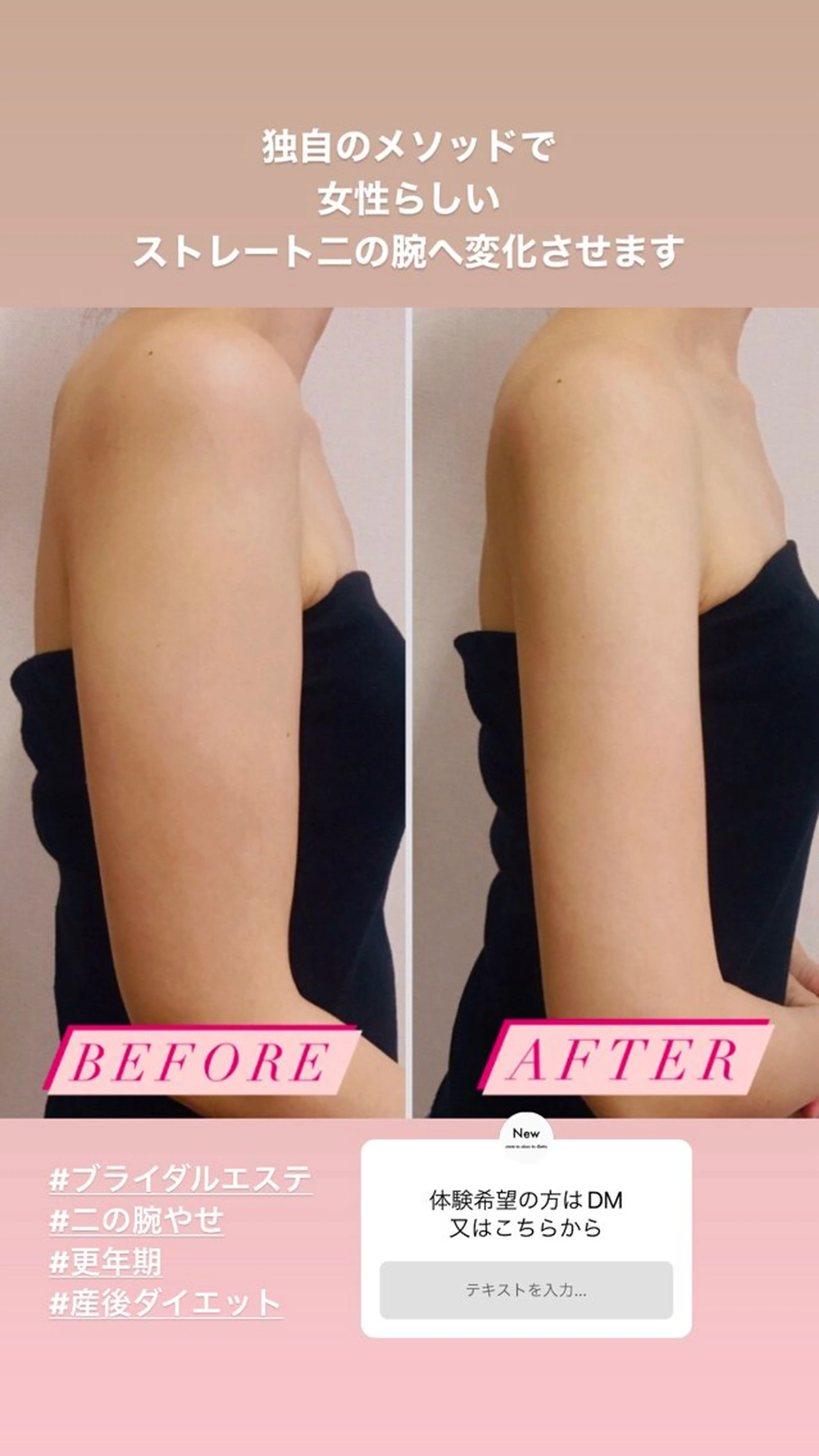 二の腕痩せ 体験の写真