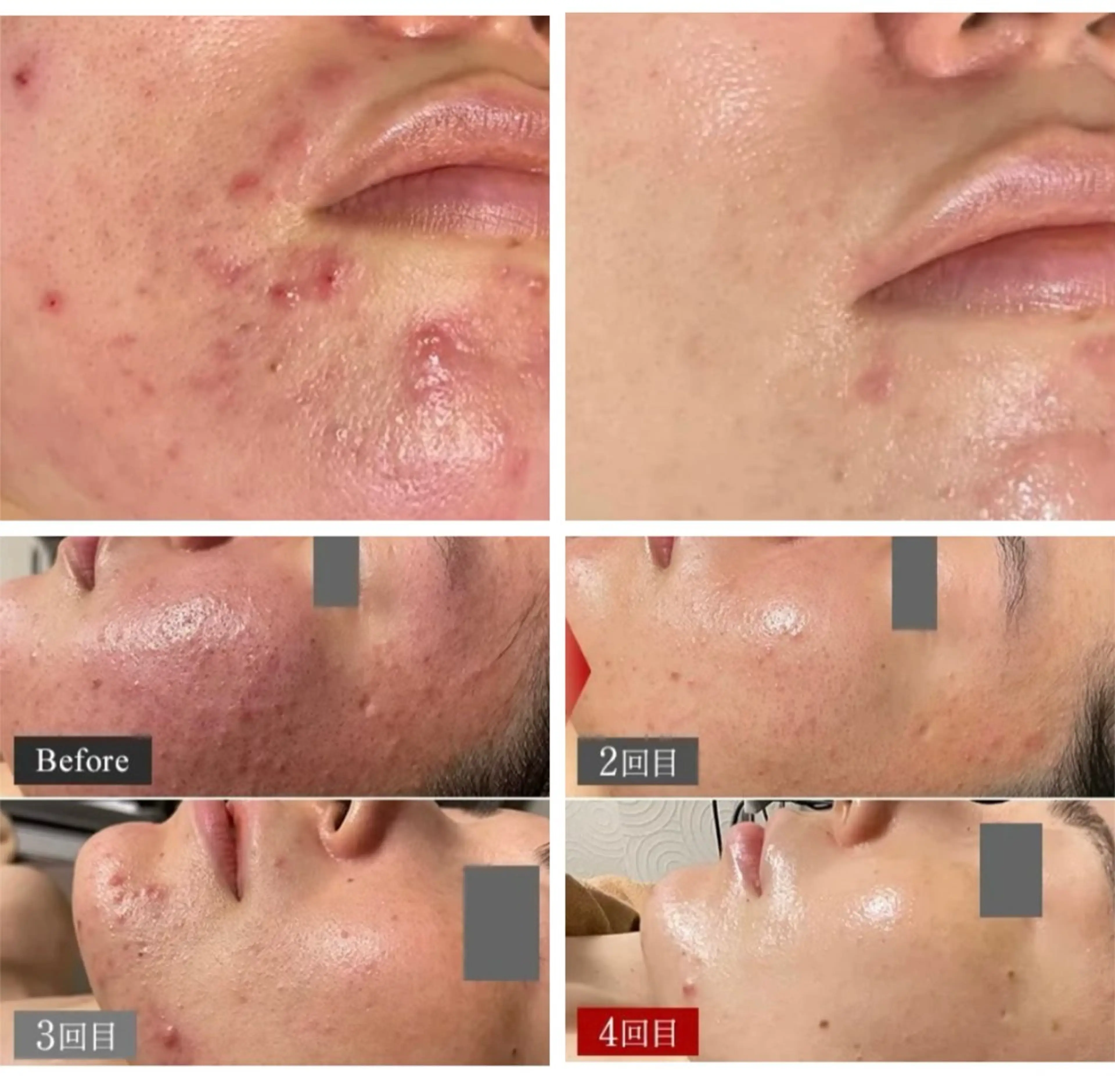 エステ im所属・nagasawa asukaのその他イメージ