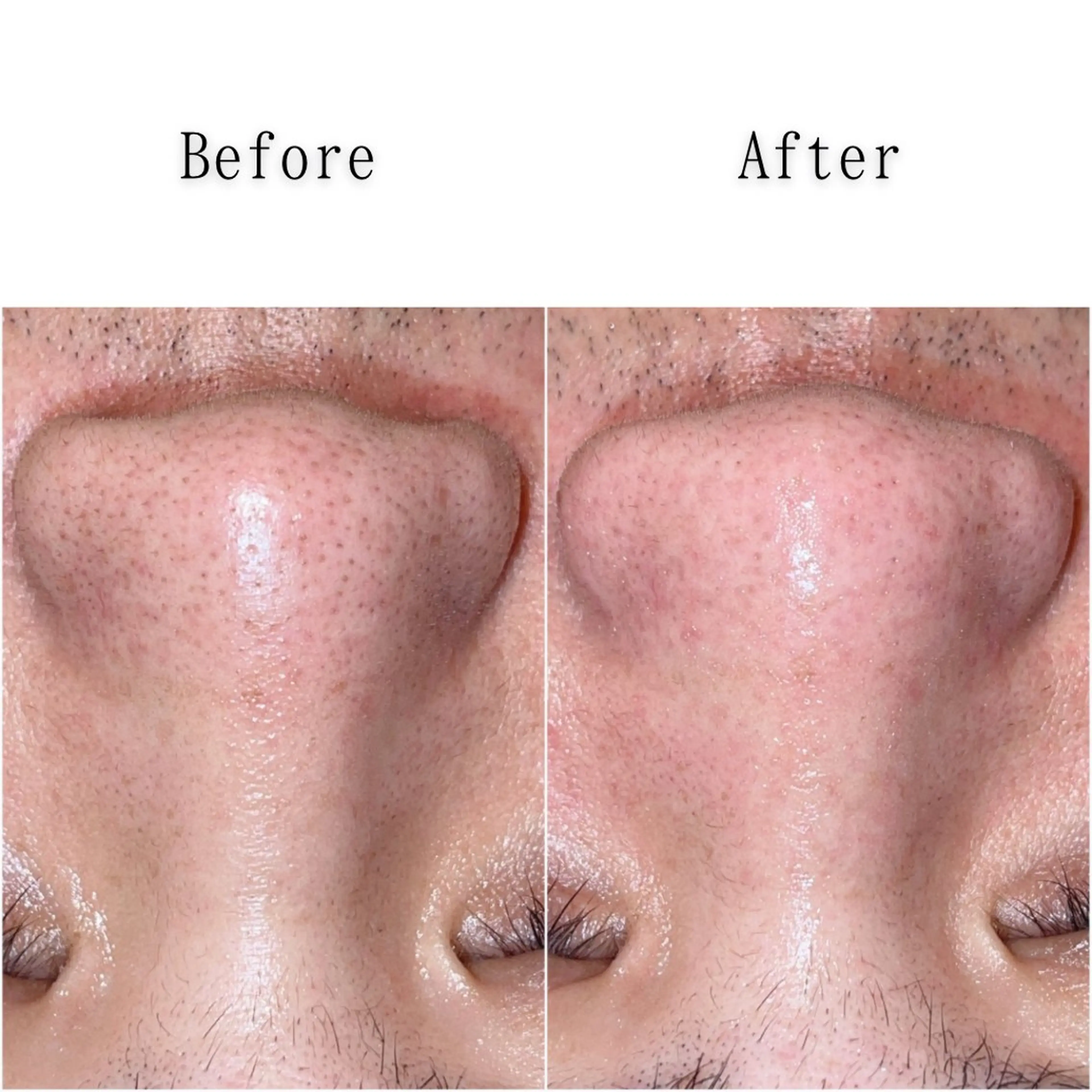 その他 SELF  BEAUTY gracia浦添店所属・gracia 浦添店のその他イメージ