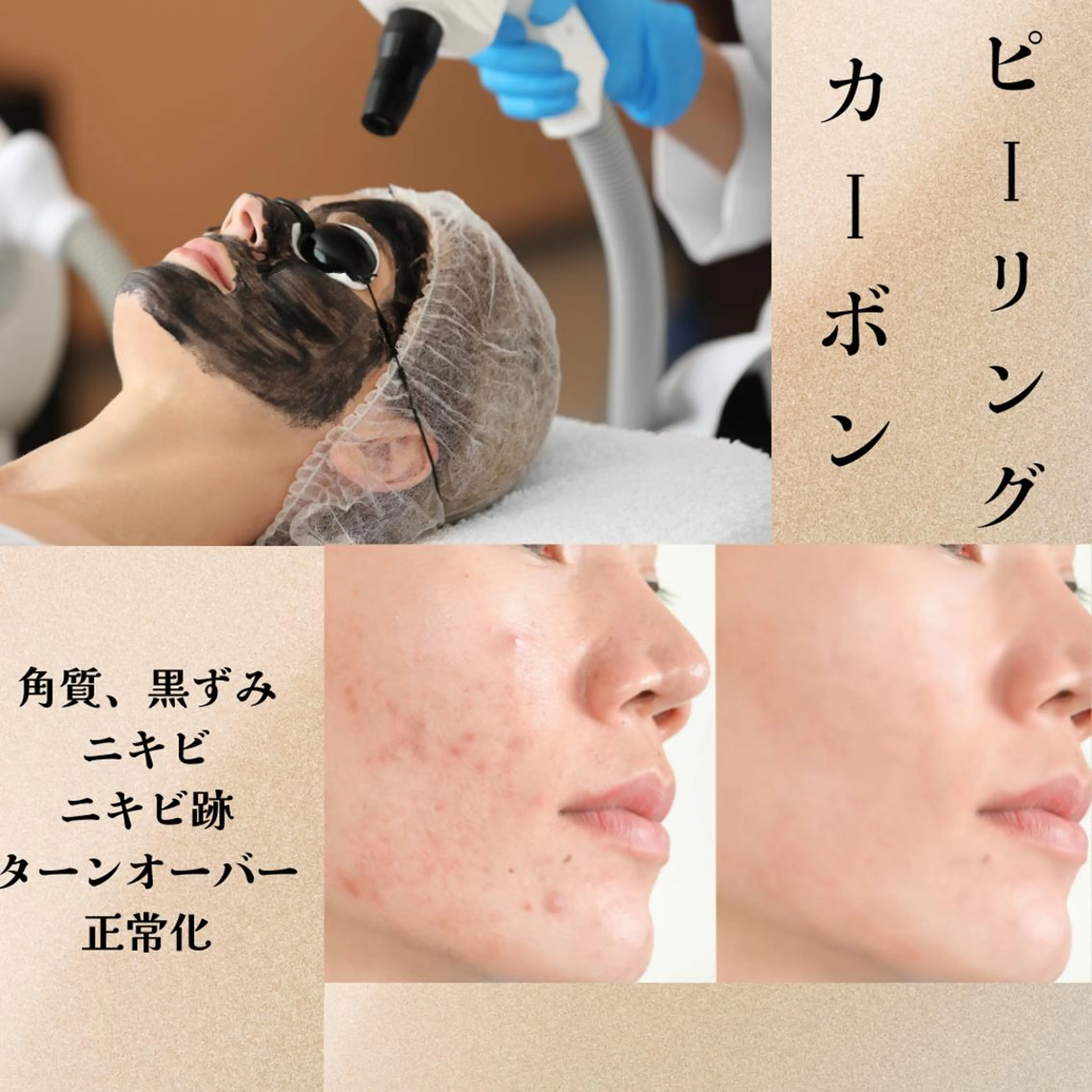 メンズ 男女同額完全個室脱毛 LEPIA内田のエステ・リラクイメージ