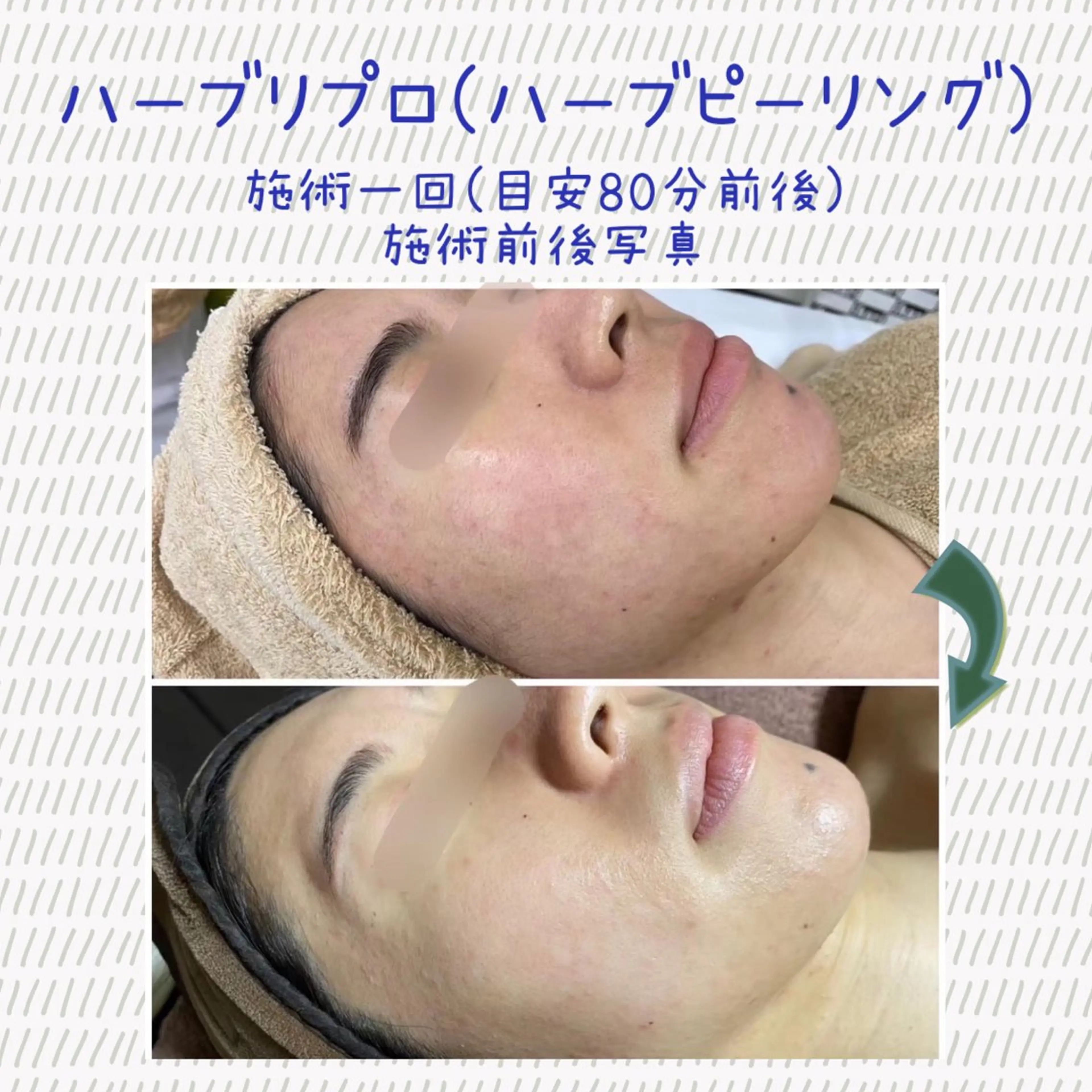 Laplace池袋本店(ラプラス池袋本店)所属・Laplace 池袋本店のその他イメージ