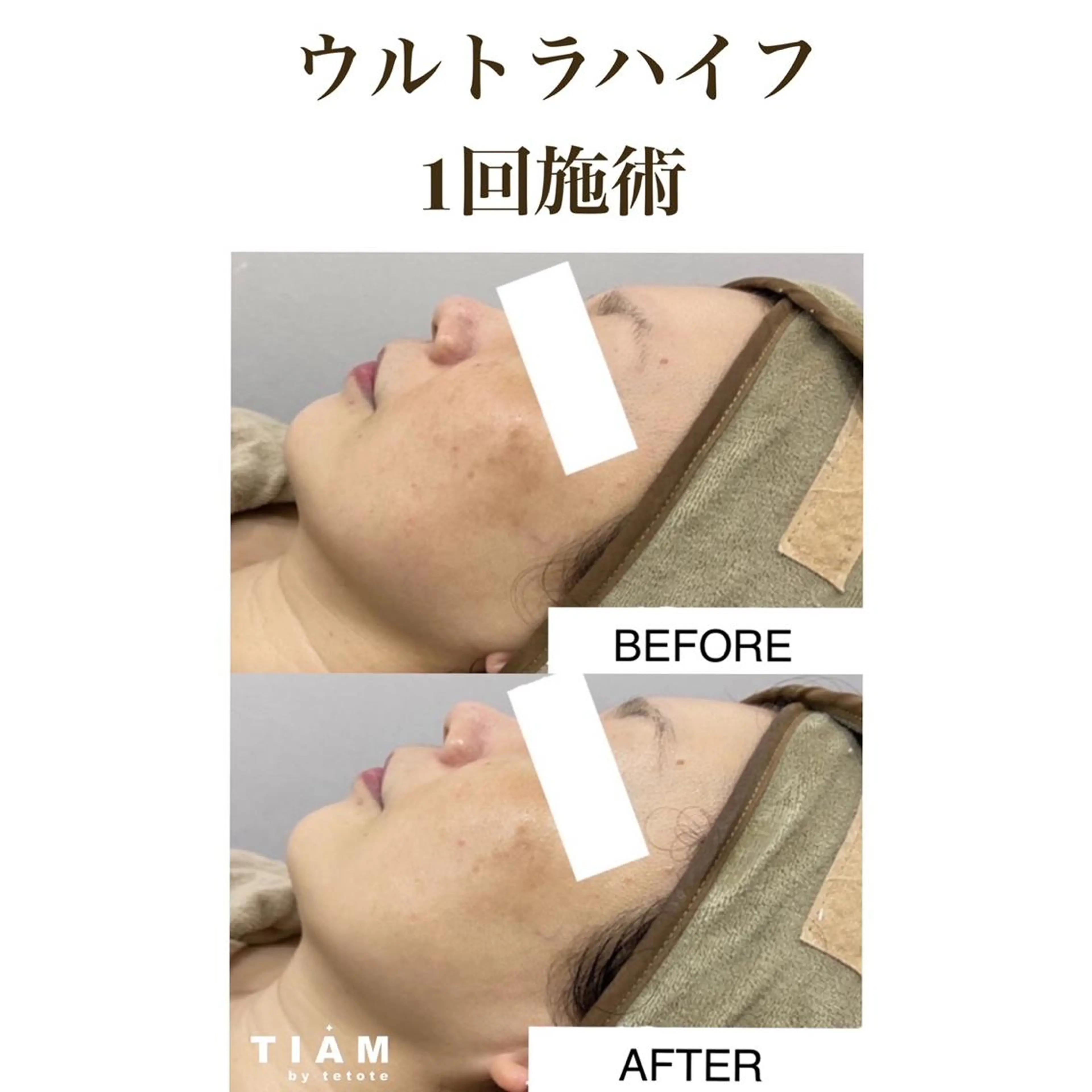 美肌サロンTIAM by tetoteのエステ・リラクイメージ