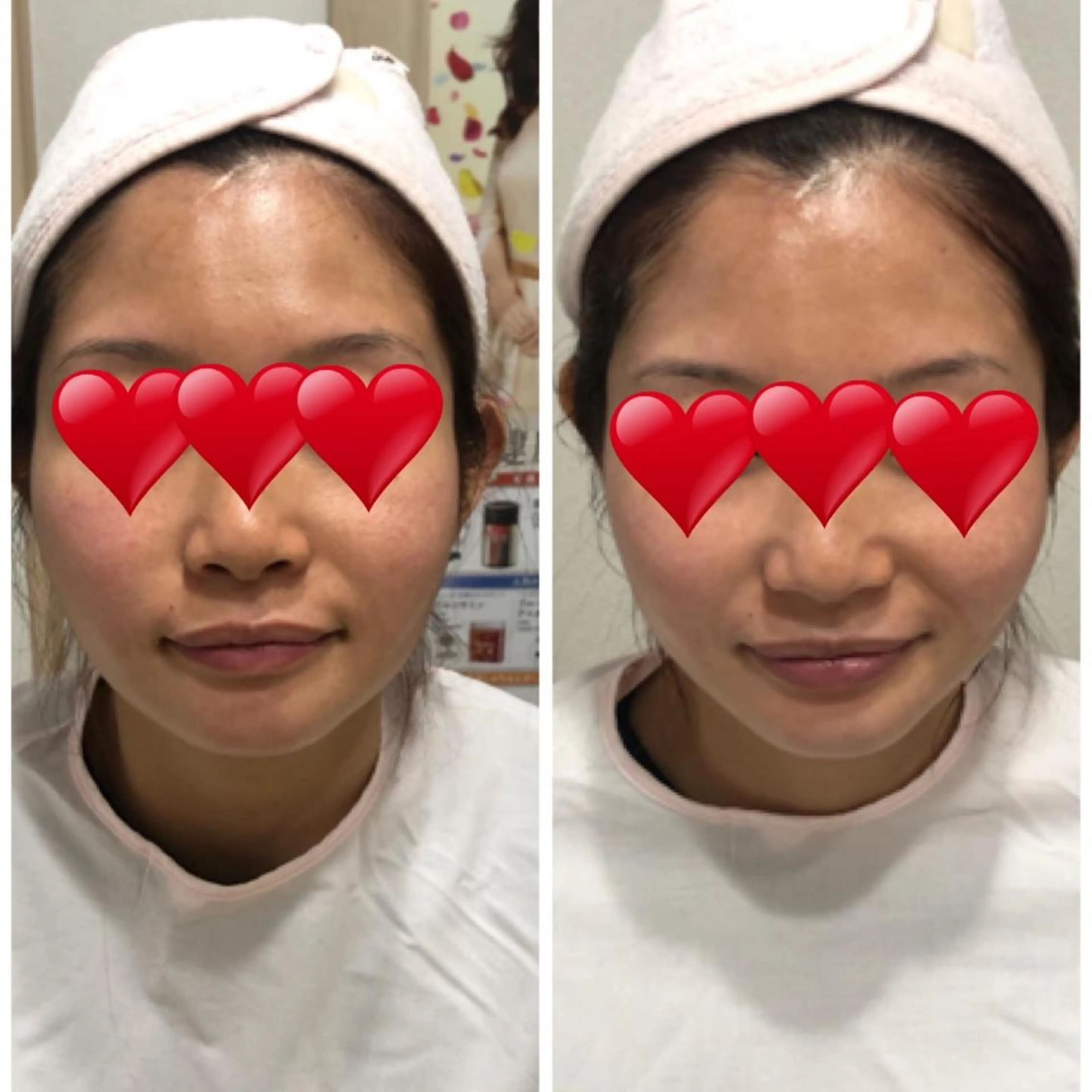 メナード　フェイシャルサロン　鳥飼野々店所属・石川 捺季のエステ・リラクイメージ