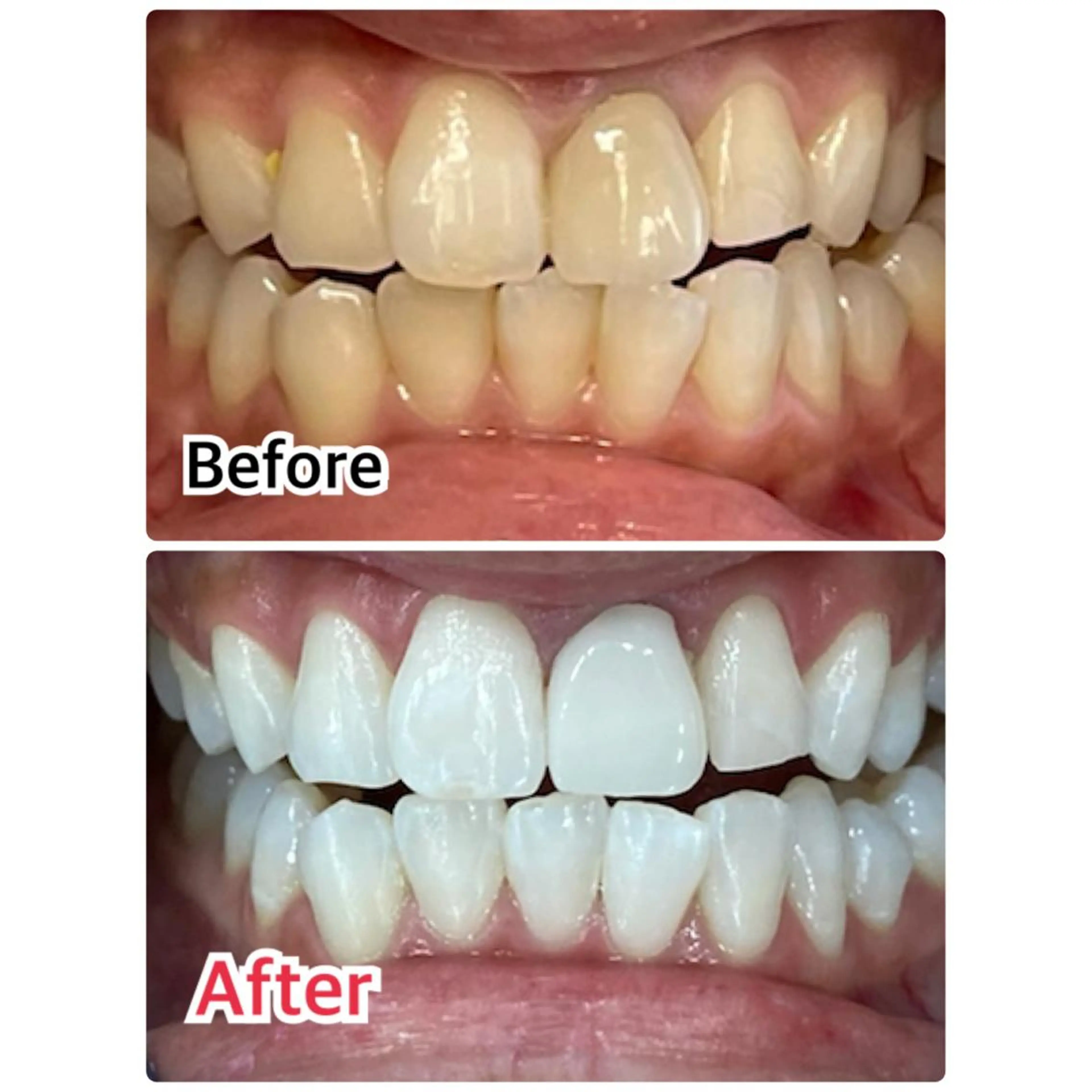 プラチナムビューティー柏所属・【歯科提携】柏ホワイ トニングスタイルのその他イメージ