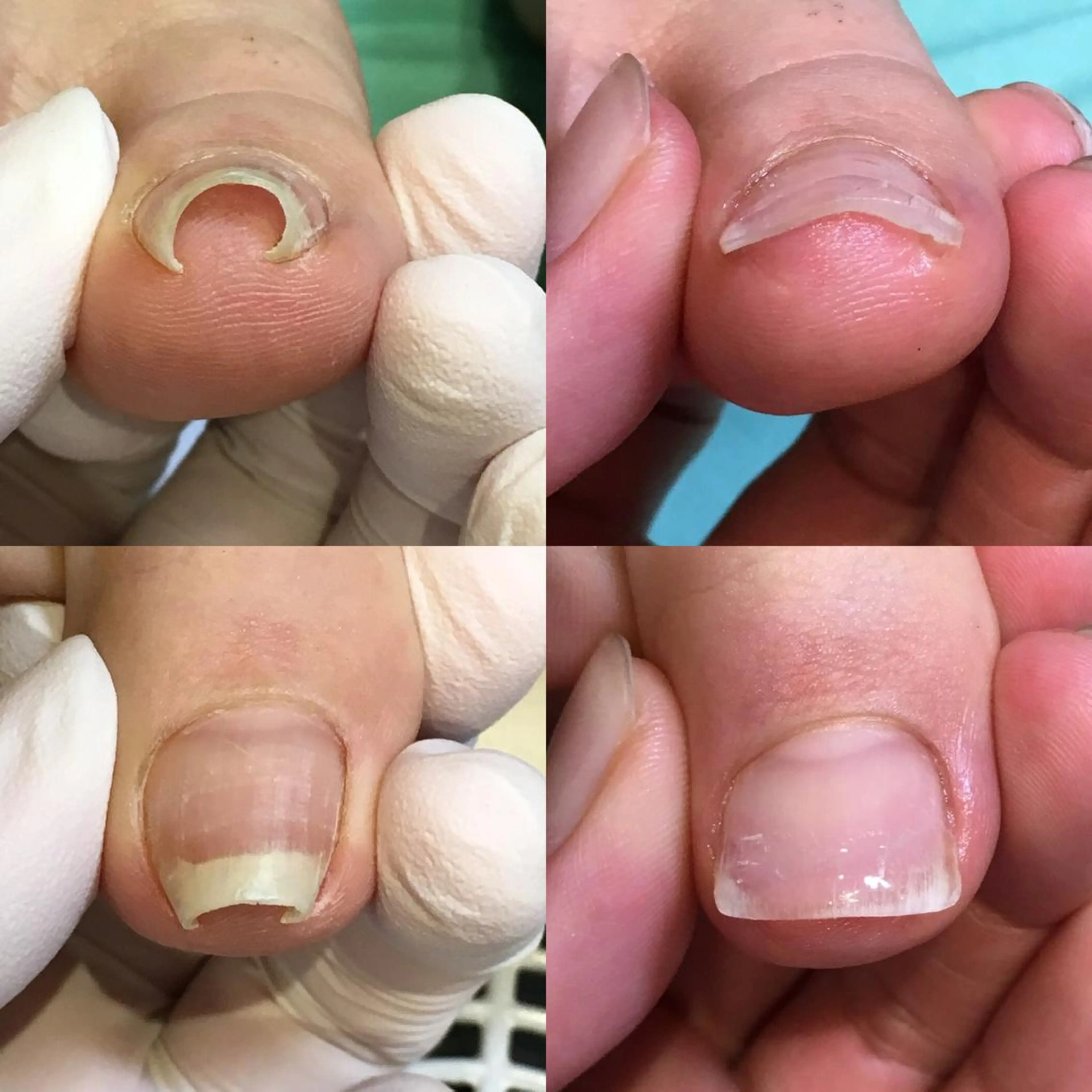 ネイル 東京巻き爪アカデミー所属・東京巻き爪 アカデミーのエステ・リラクイメージ