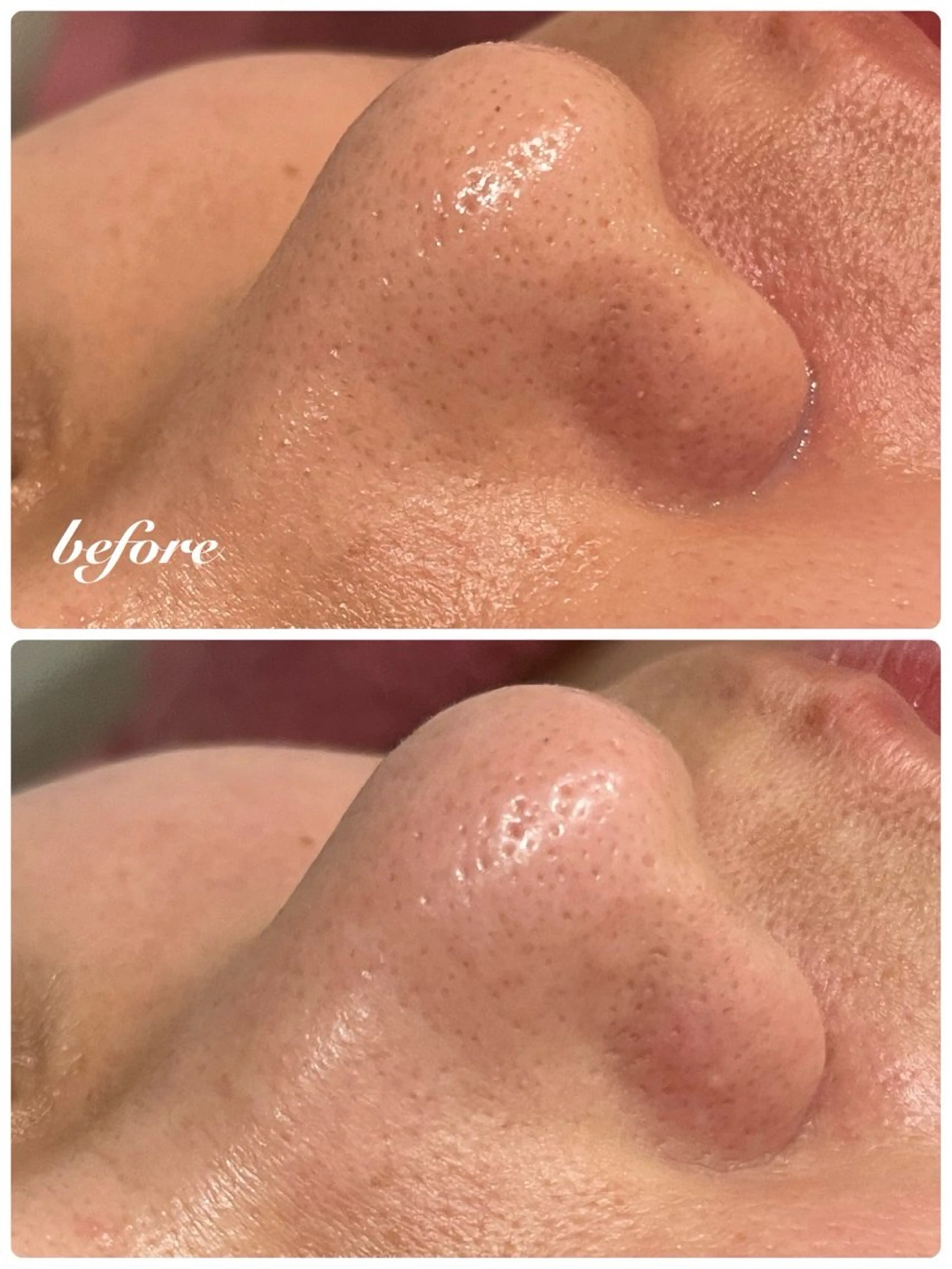 アンシャンテ トータルビューティーのエステ・リラクイメージ