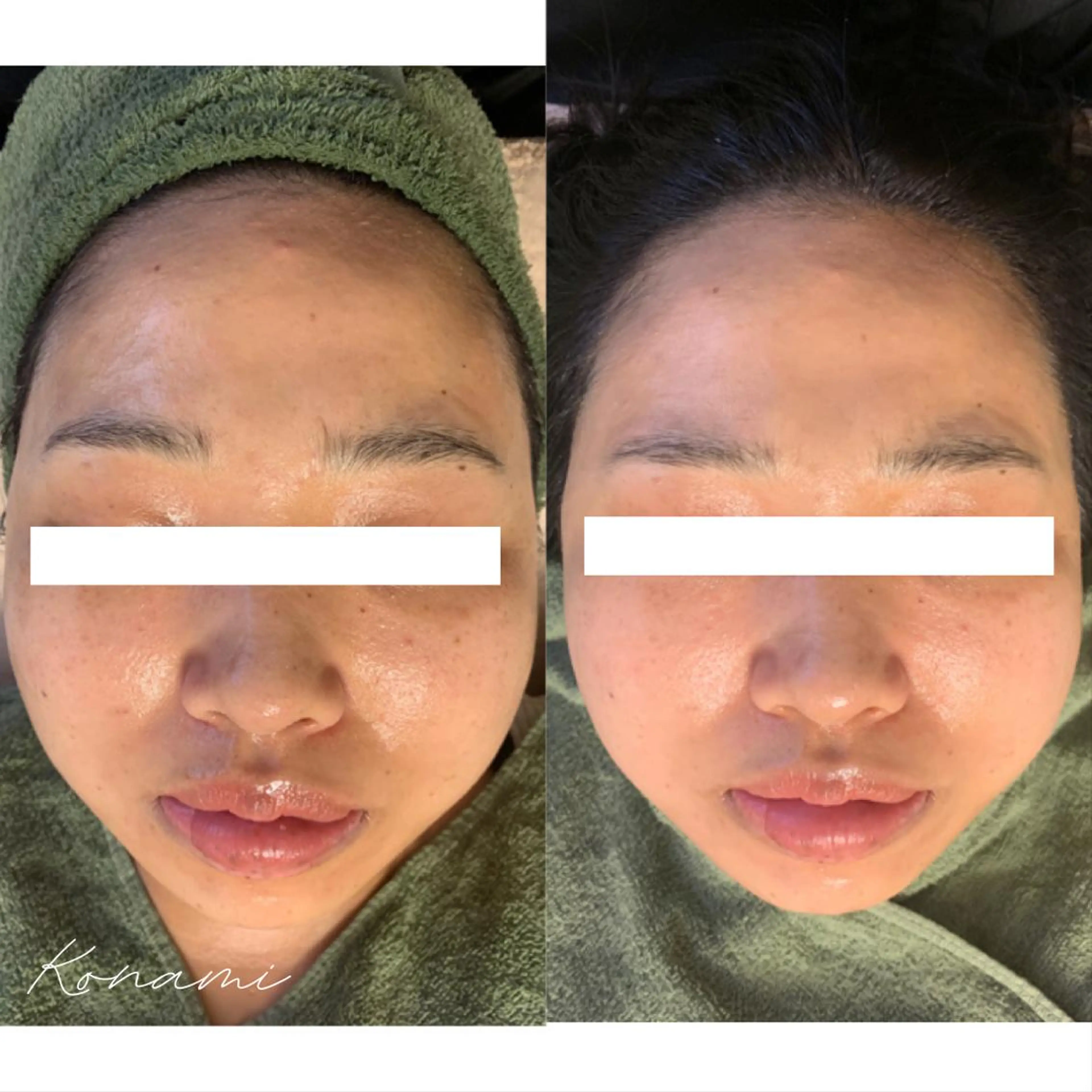 エステ シードリン 府内店 小波のエステ・リラクイメージ