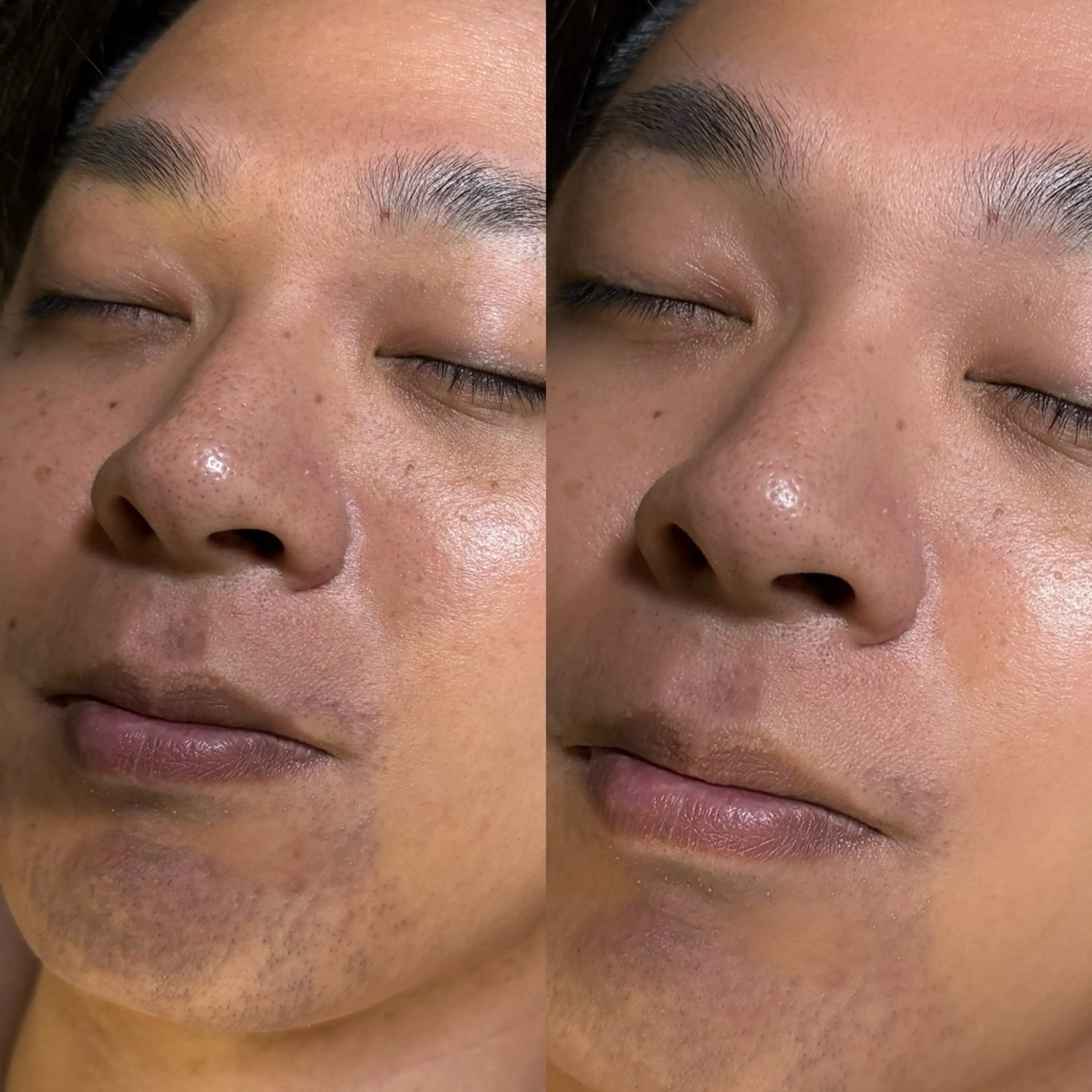 エステ 六本木脱毛andS 店長Sachiのエステ・リラクイメージ