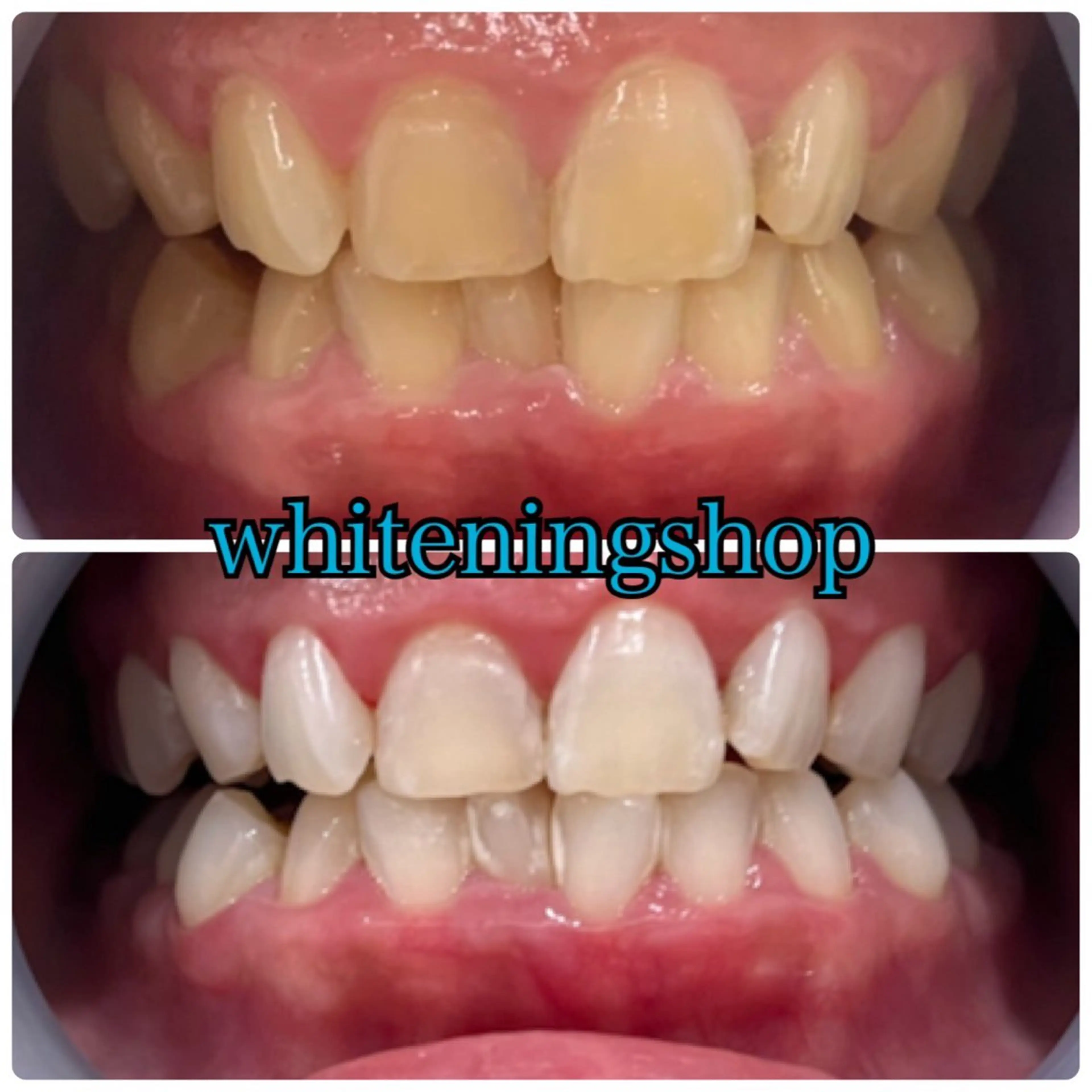 メンズ エステ リラク ホワイトニング ショップ川越店のエステ・リラクイメージ