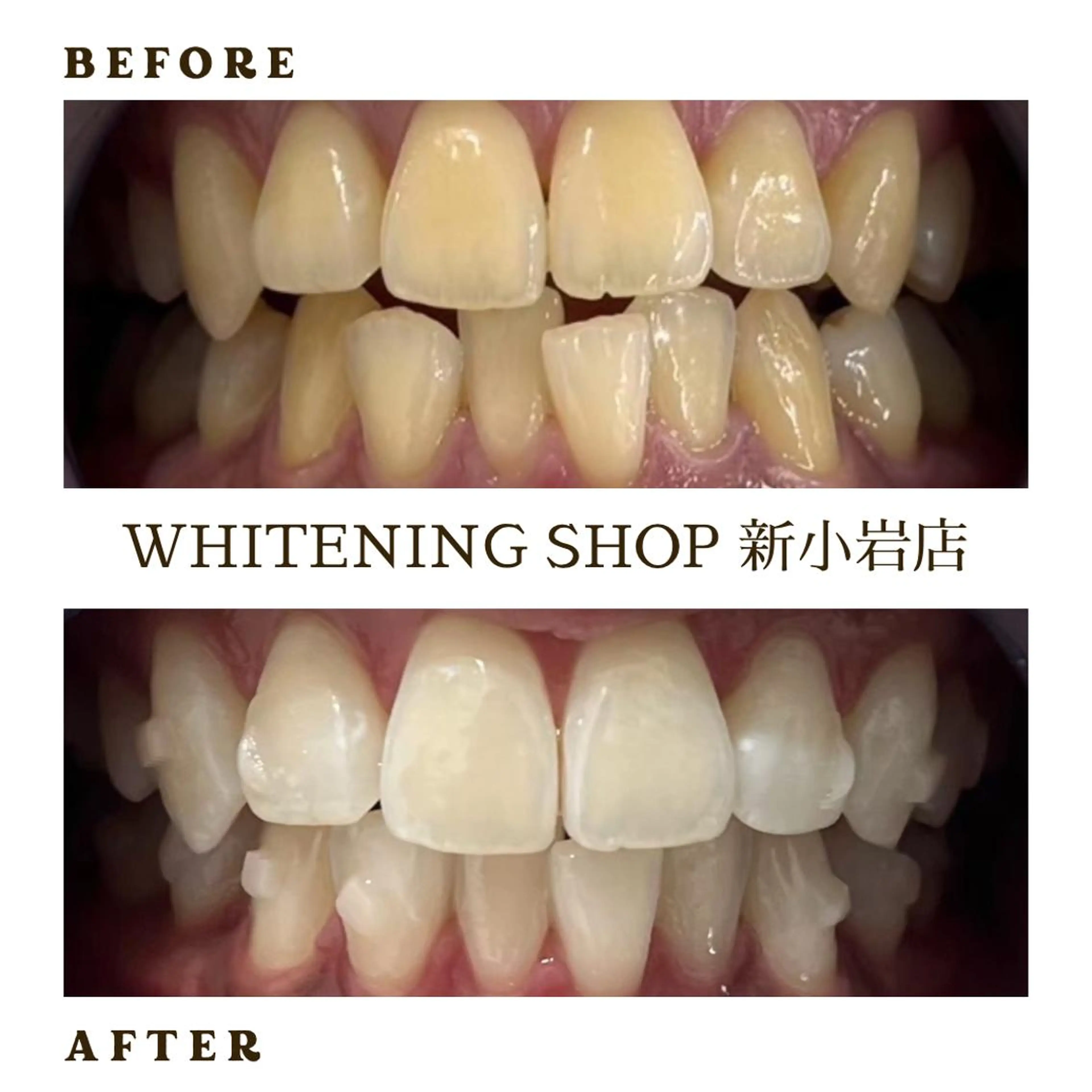 メンズ その他 ホワイトニング ショップ新小岩店のその他イメージ