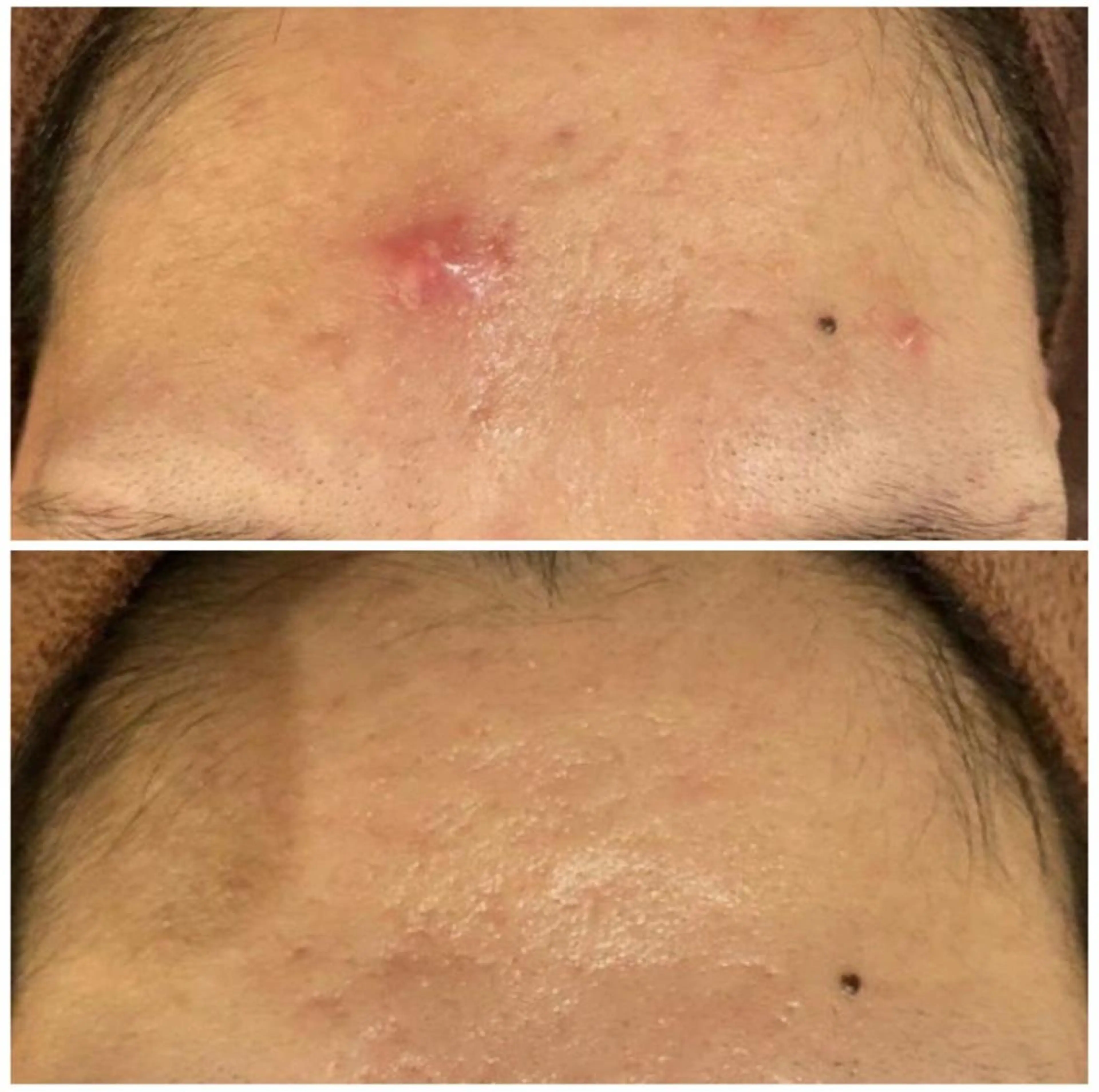 夏までに肌荒れ卒業 するサロン🌻のエステ・リラクイメージ