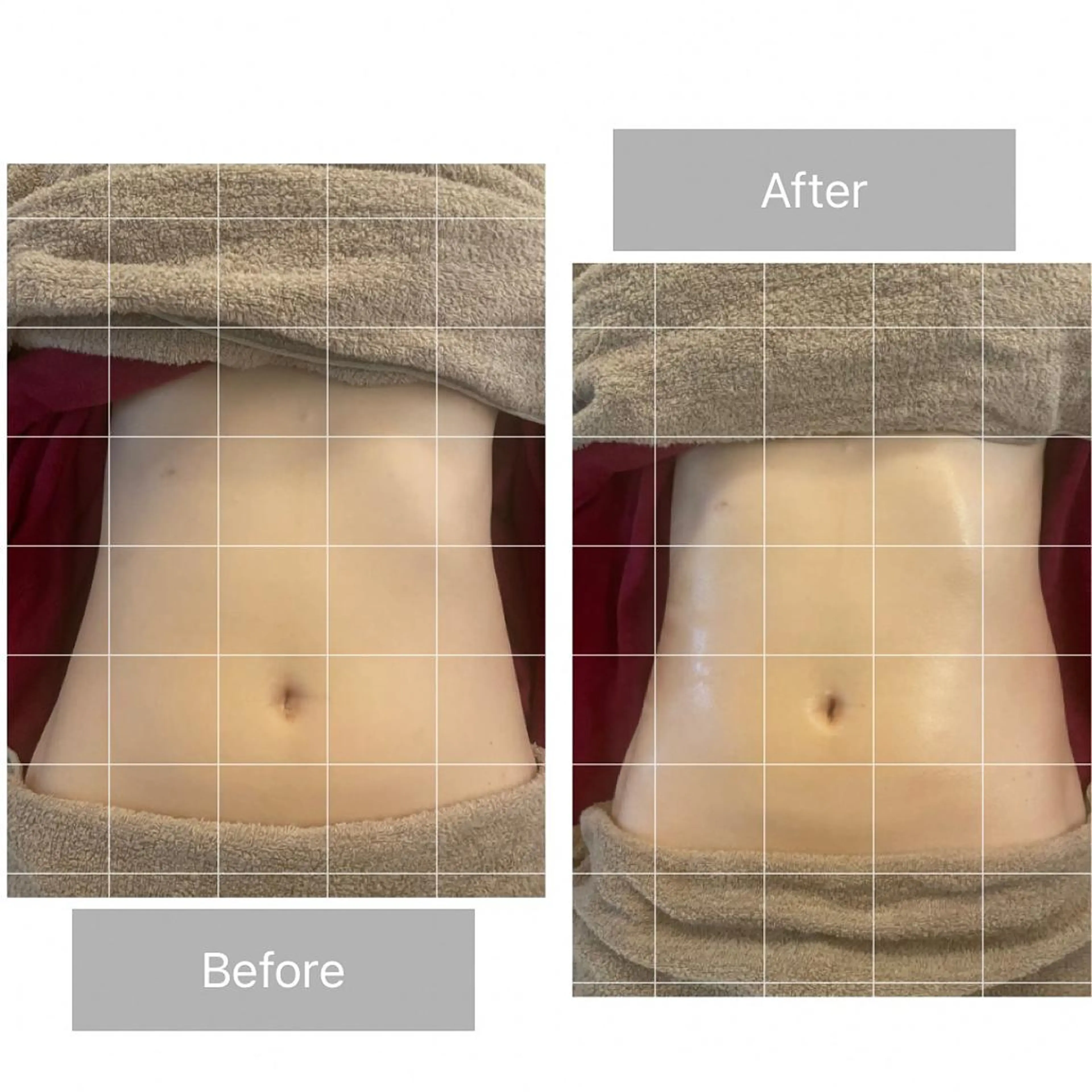 【ウエストまわりすっきり◎】腸マッサージ 40分の写真