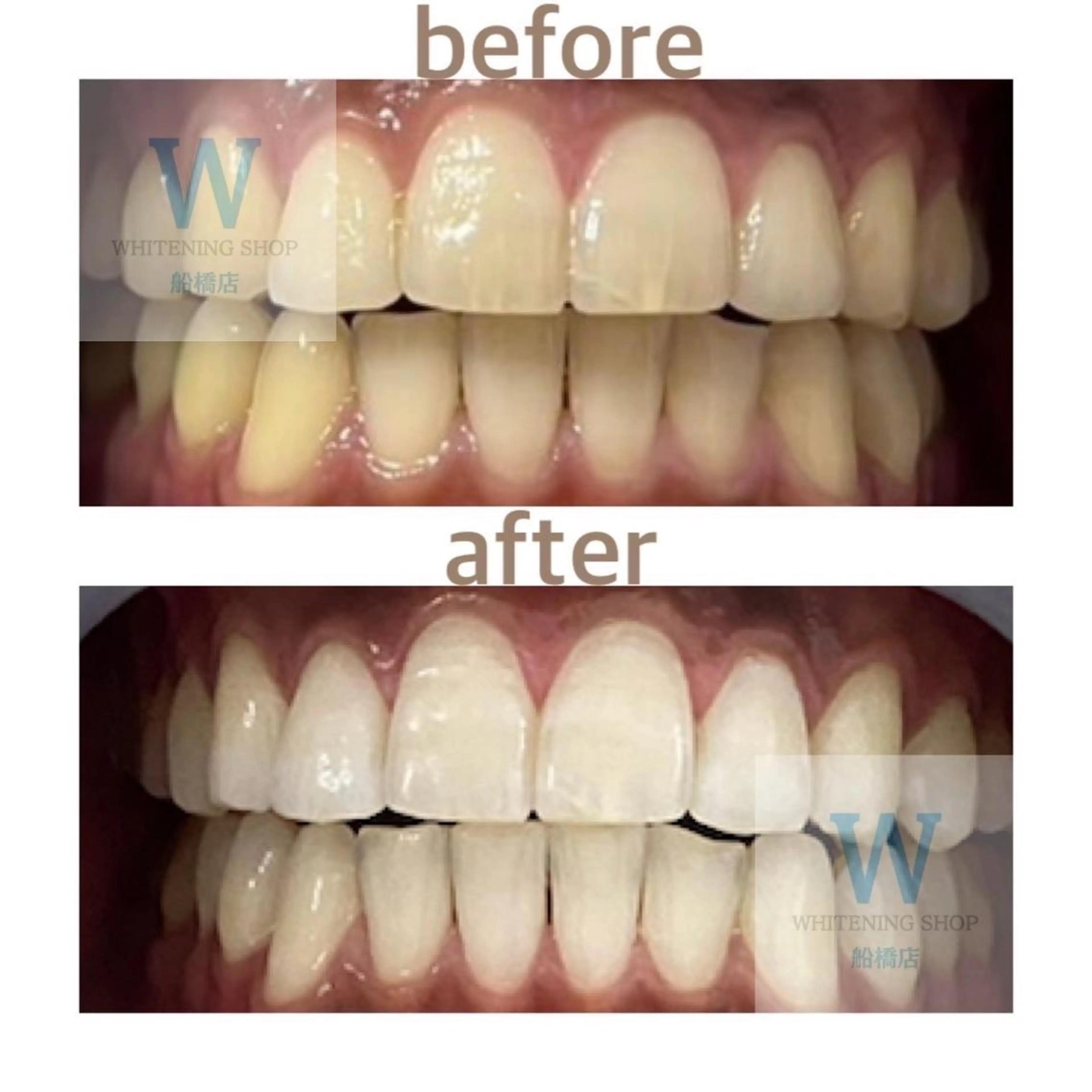 エステ リラク ホワイトニング ショップ船橋２号店のエステ・リラクイメージ