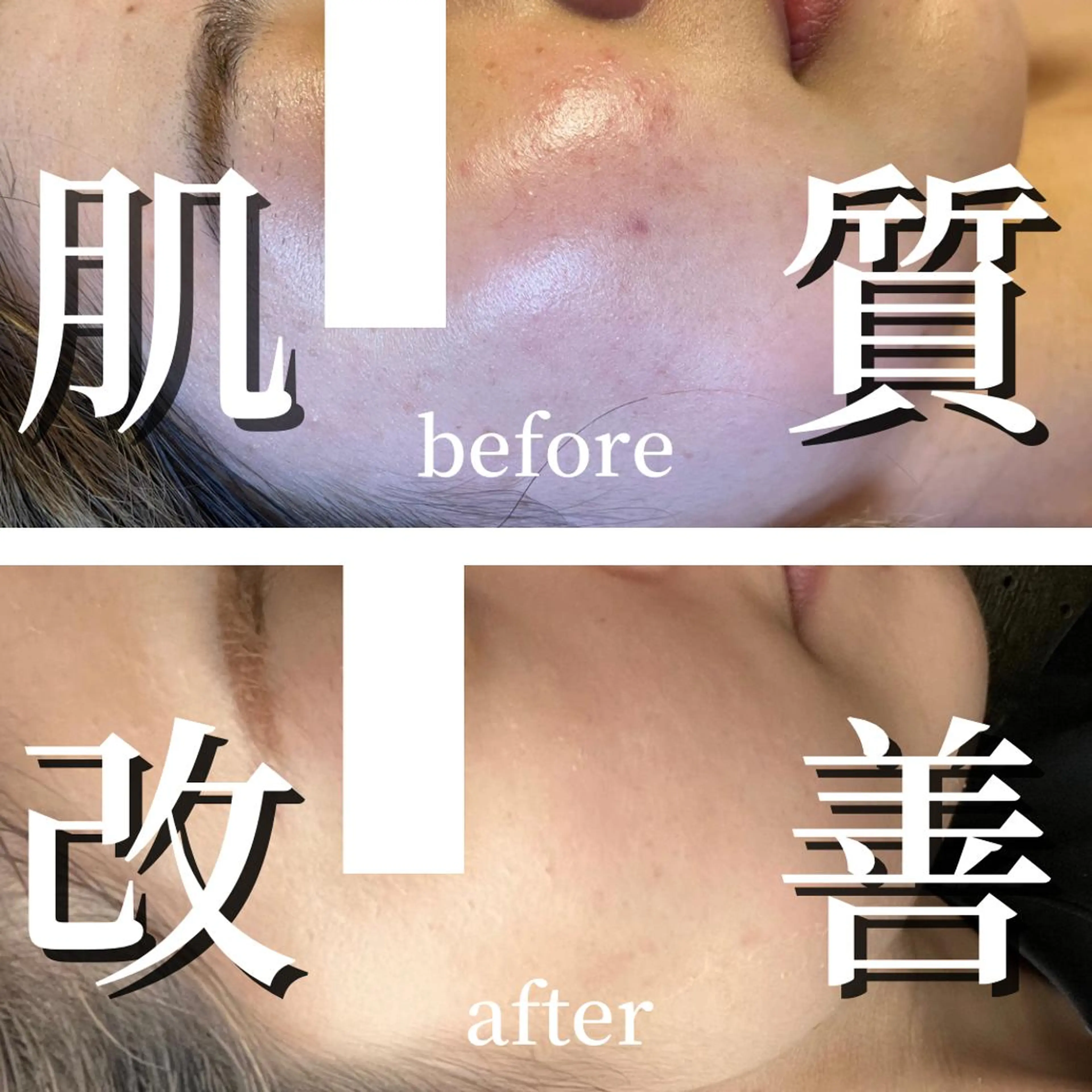 小顔サロン AMYONのエステ・リラクイメージ