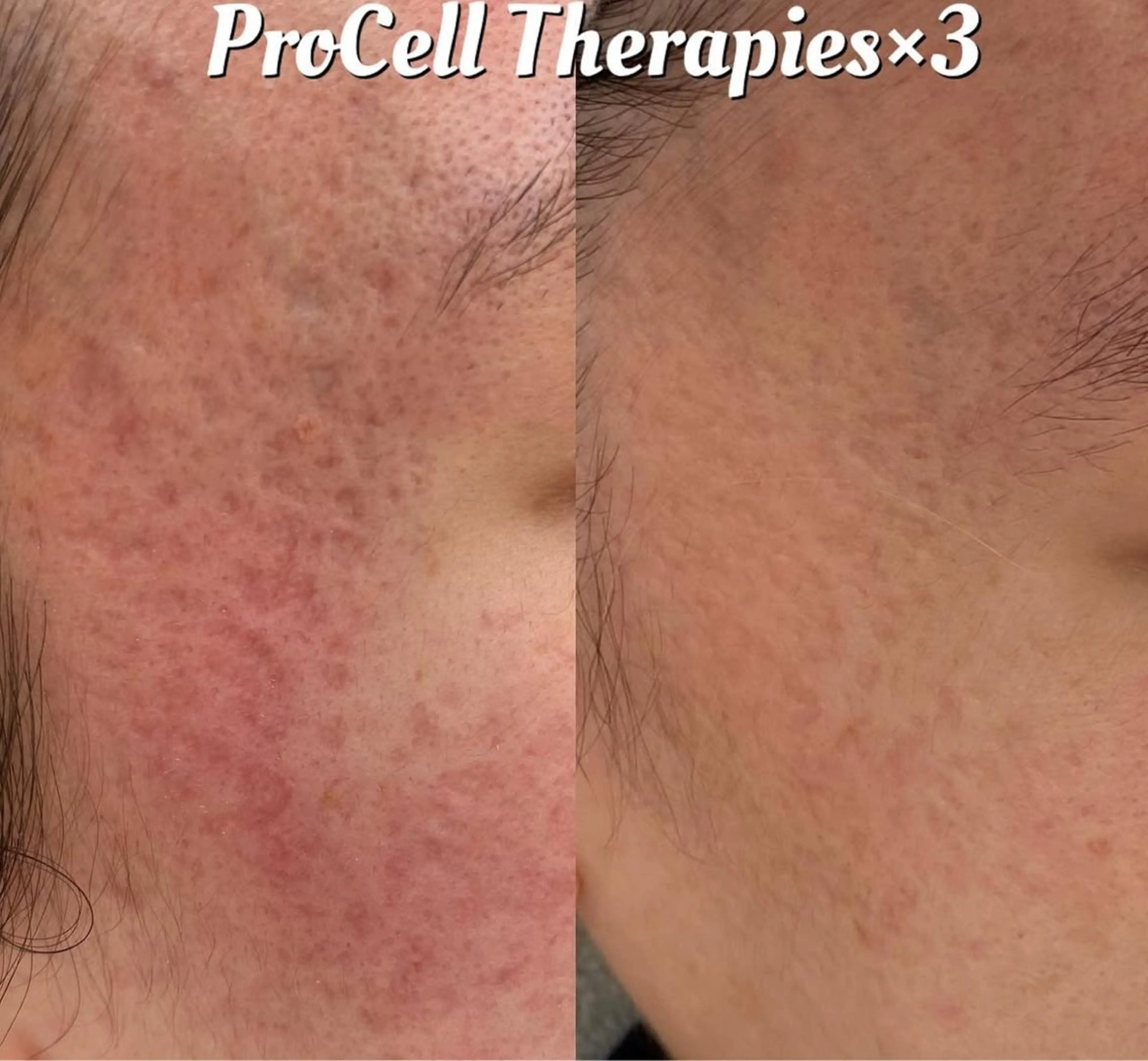 メンズ Blooming所属・LOUISE. ／肌質・頭皮のエステ・リラクイメージ