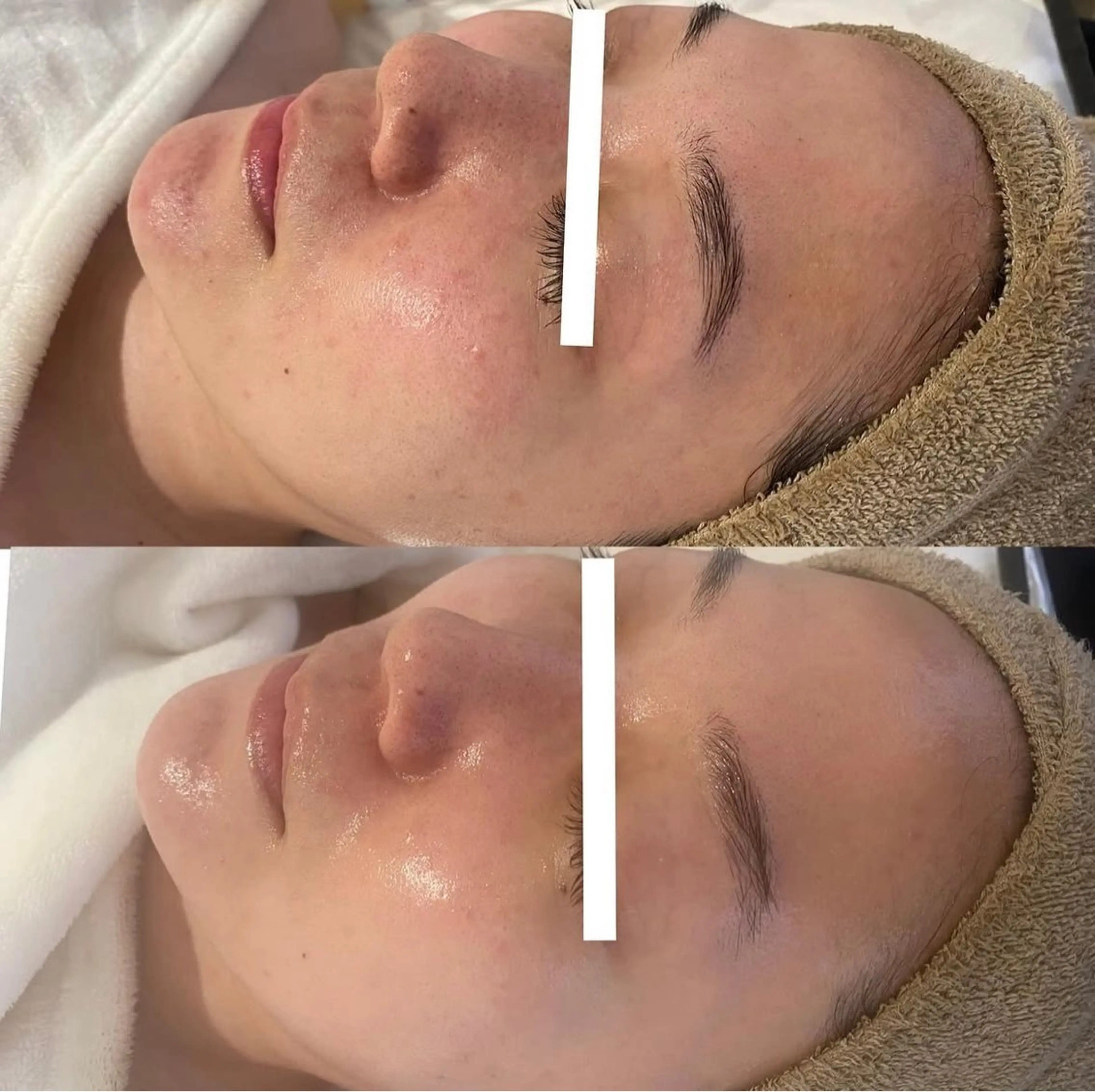 中目黒ハーブピーリン グ🌿ララピールのエステ・リラクイメージ