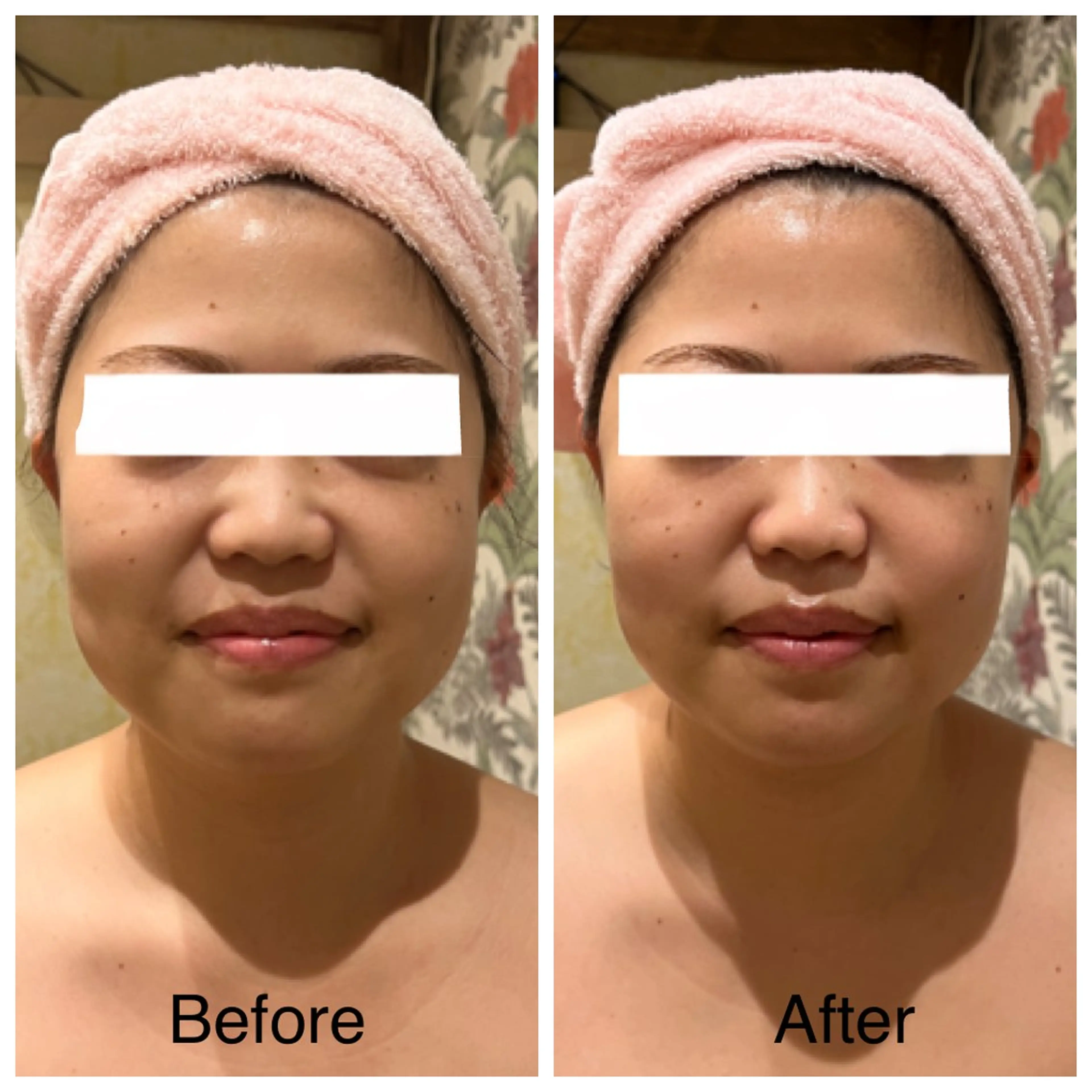 Relaxation SalonARONAのエステ・リラクイメージ