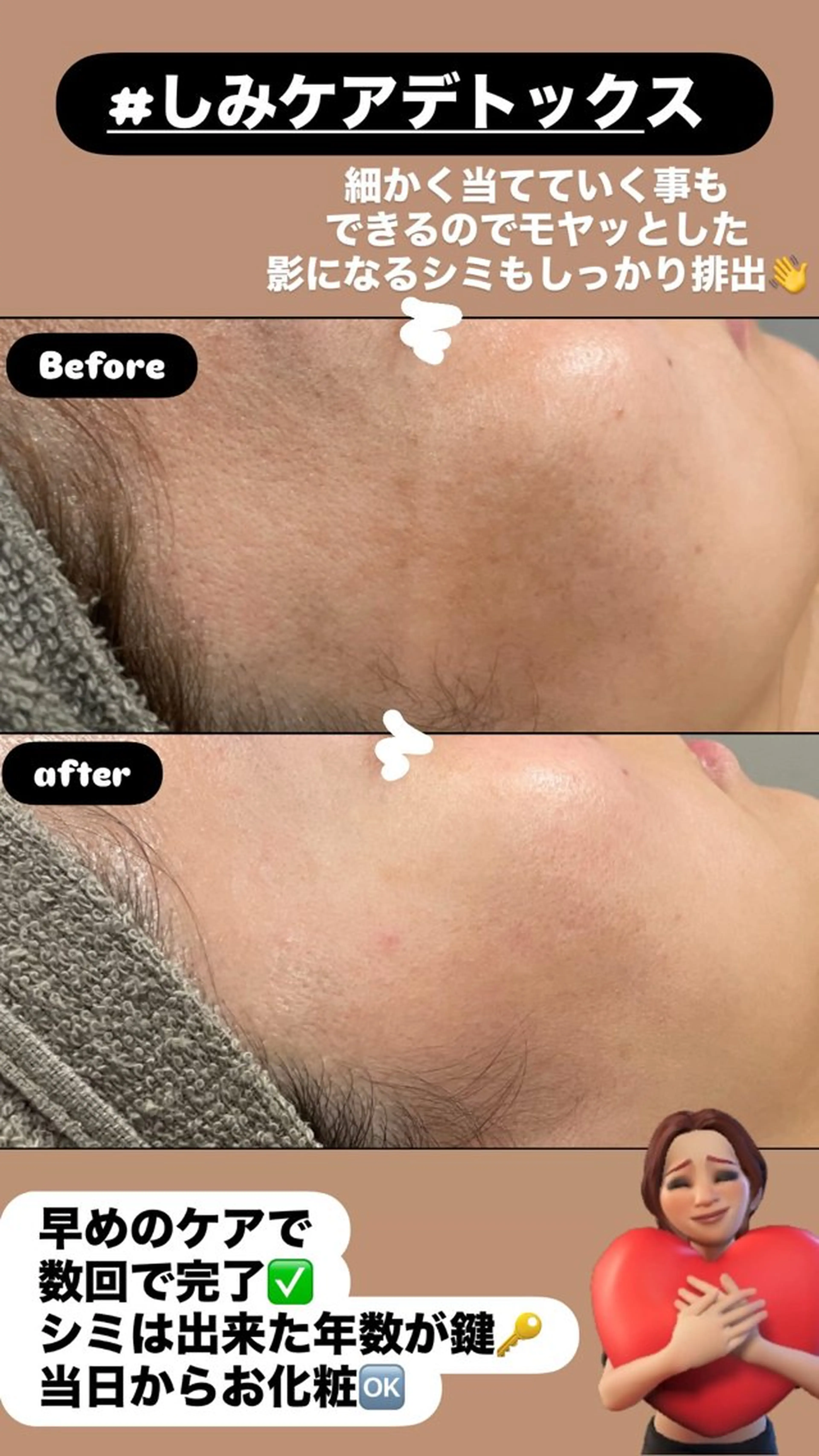 エステ LiZA エステティックサロンのその他イメージ