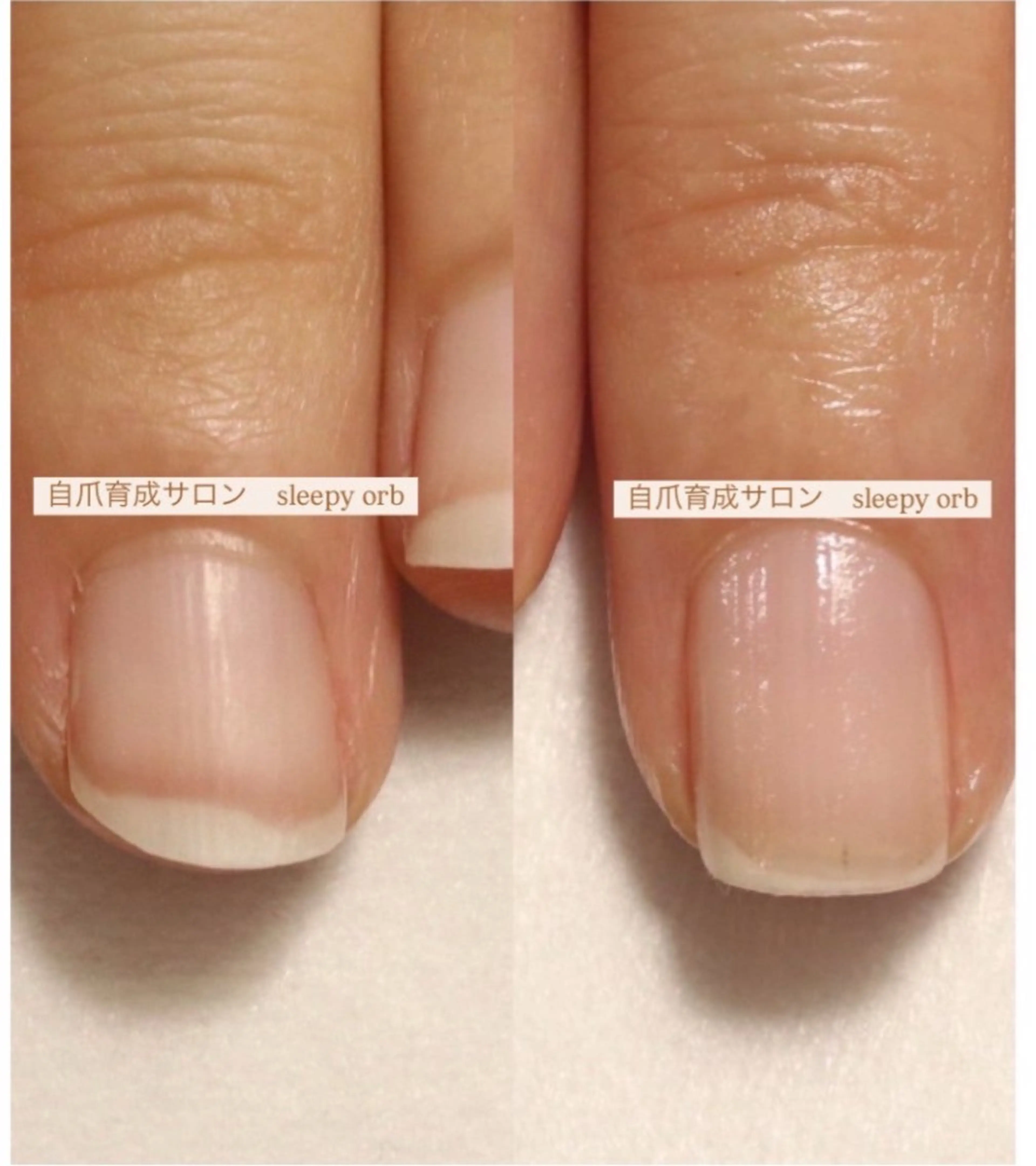 自爪育成体験(深爪、平ら爪、ピンクを伸ばしたい)お悩み爪を理想の美爪へ変えたい方。お仕事等でジェルが出来ない方にもの写真