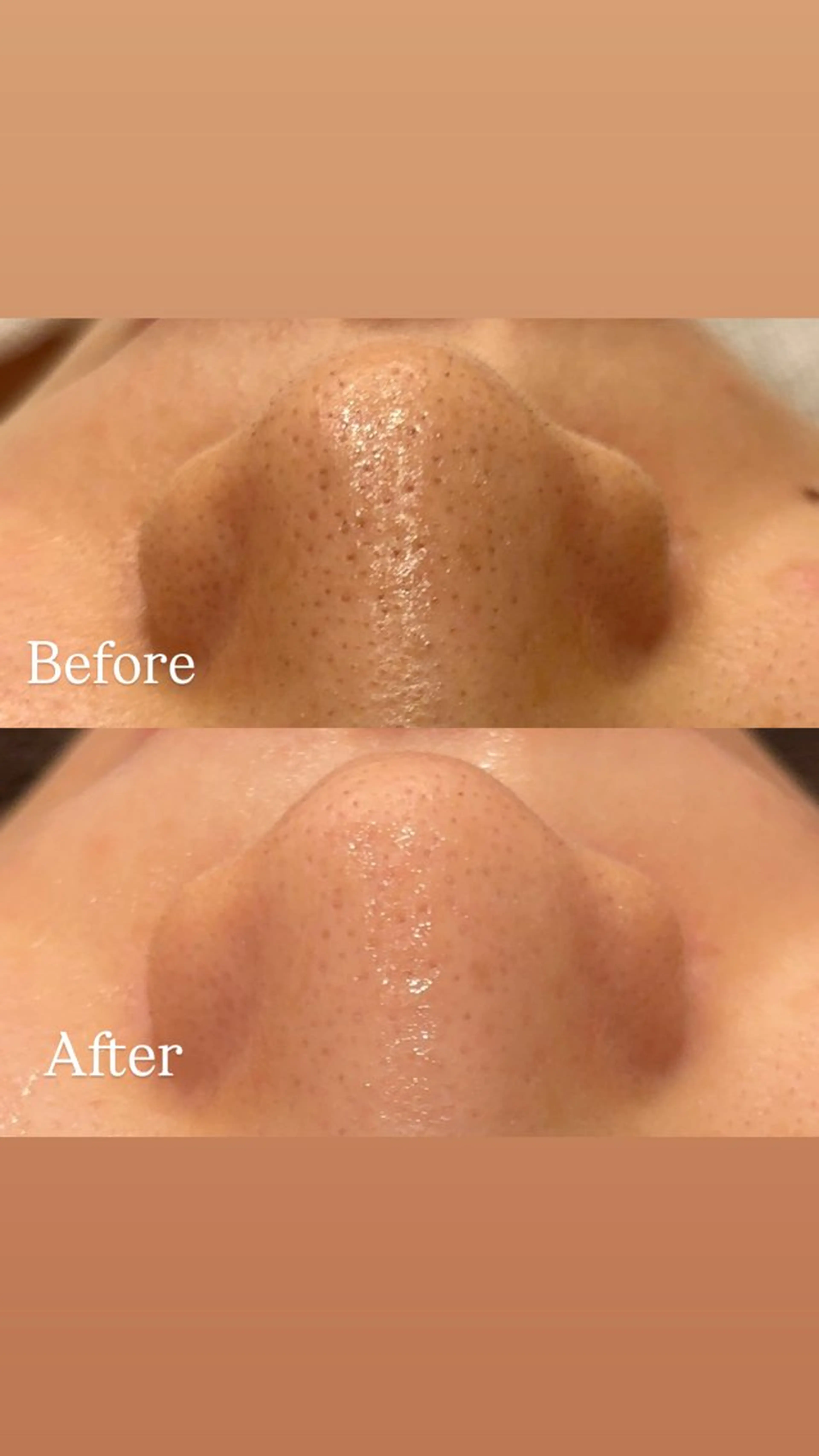 Hari Lounge恵比寿所属・chika🦋 ハリラウンジ恵比寿のエステ・リラクイメージ