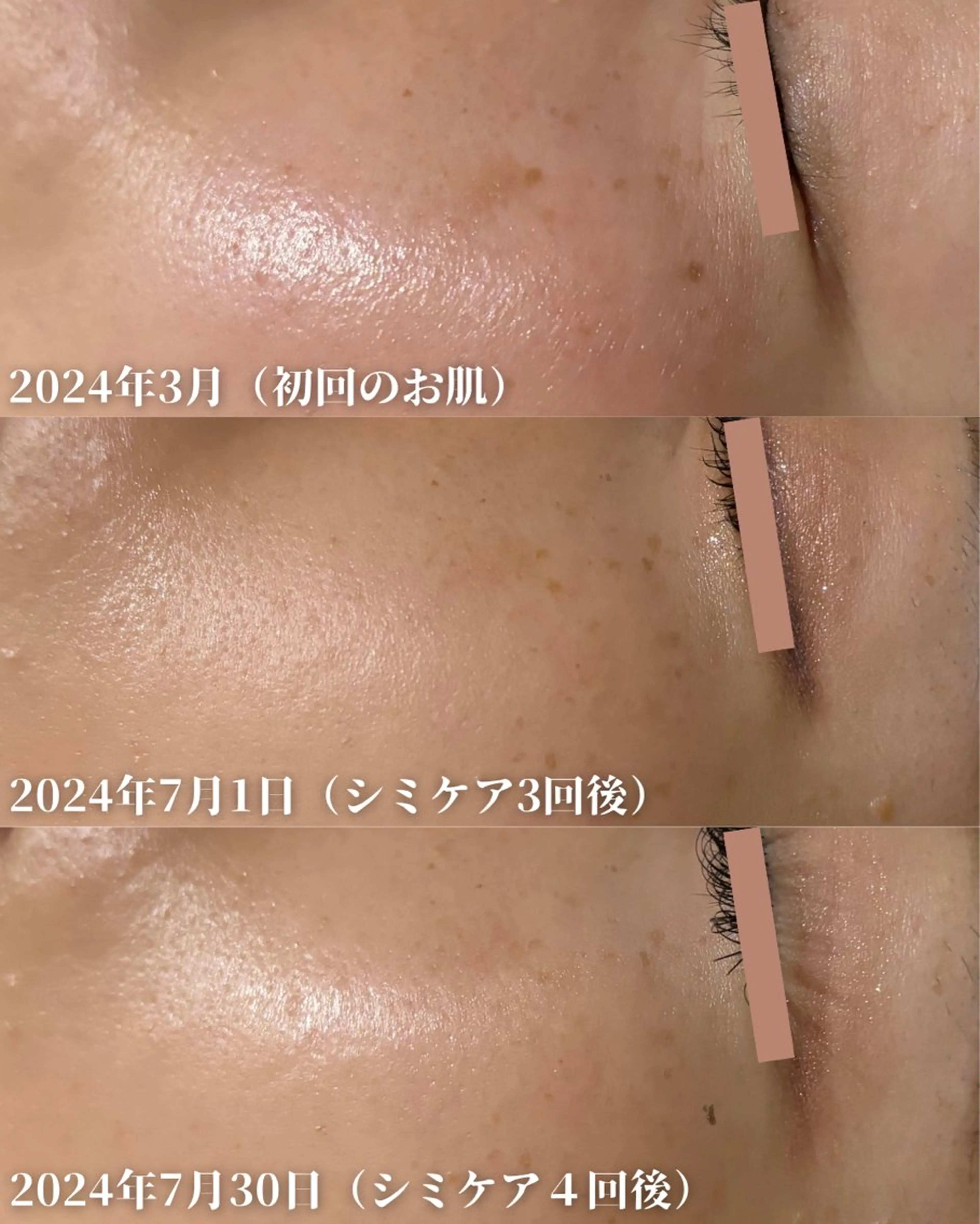 エステ NADEKA所属・河原町NADEKA シミケア/ララピールのエステ・リラクイメージ