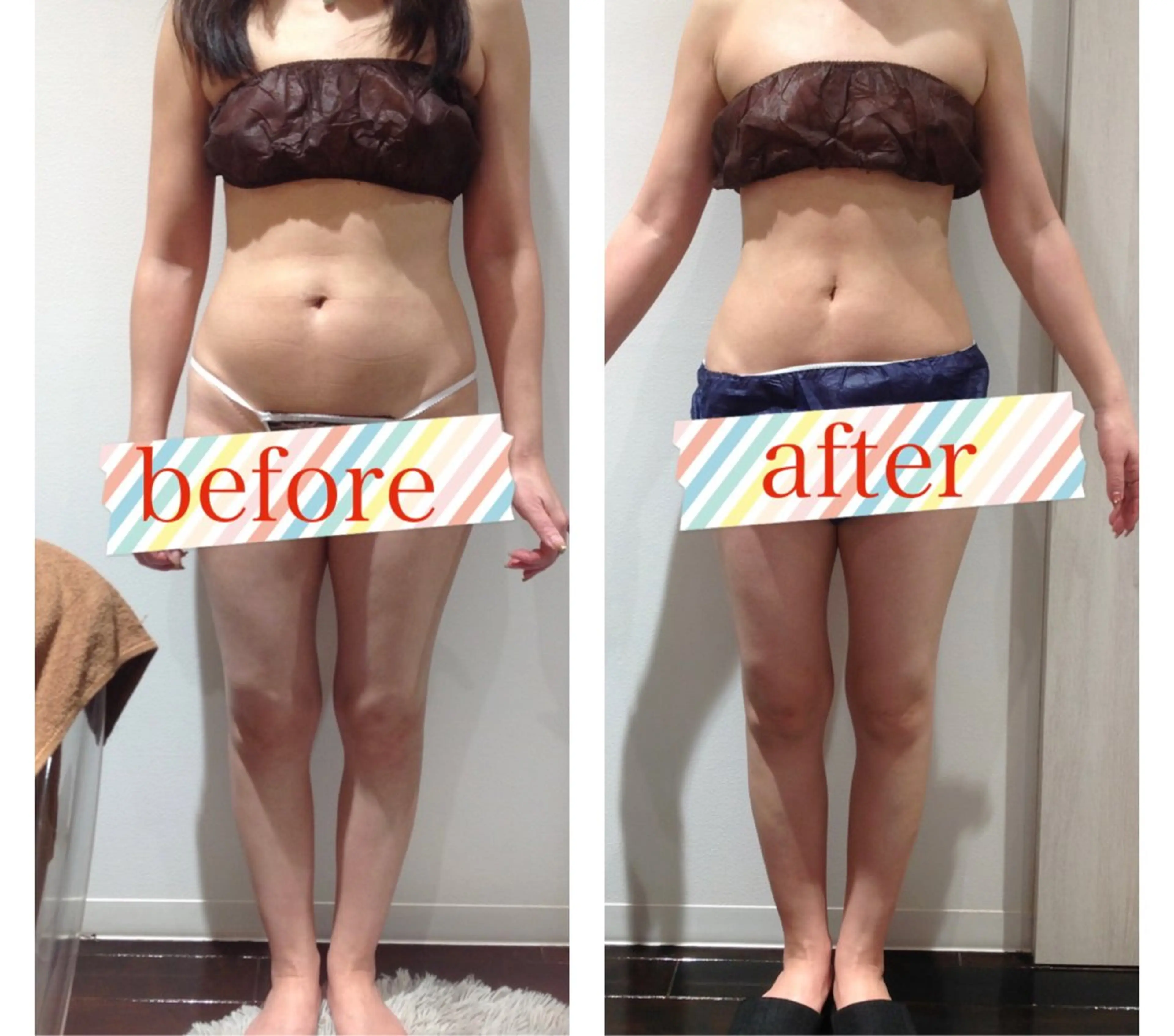 脱毛フェイシャル痩身 エリア最安👑永野舞のエステ・リラクイメージ