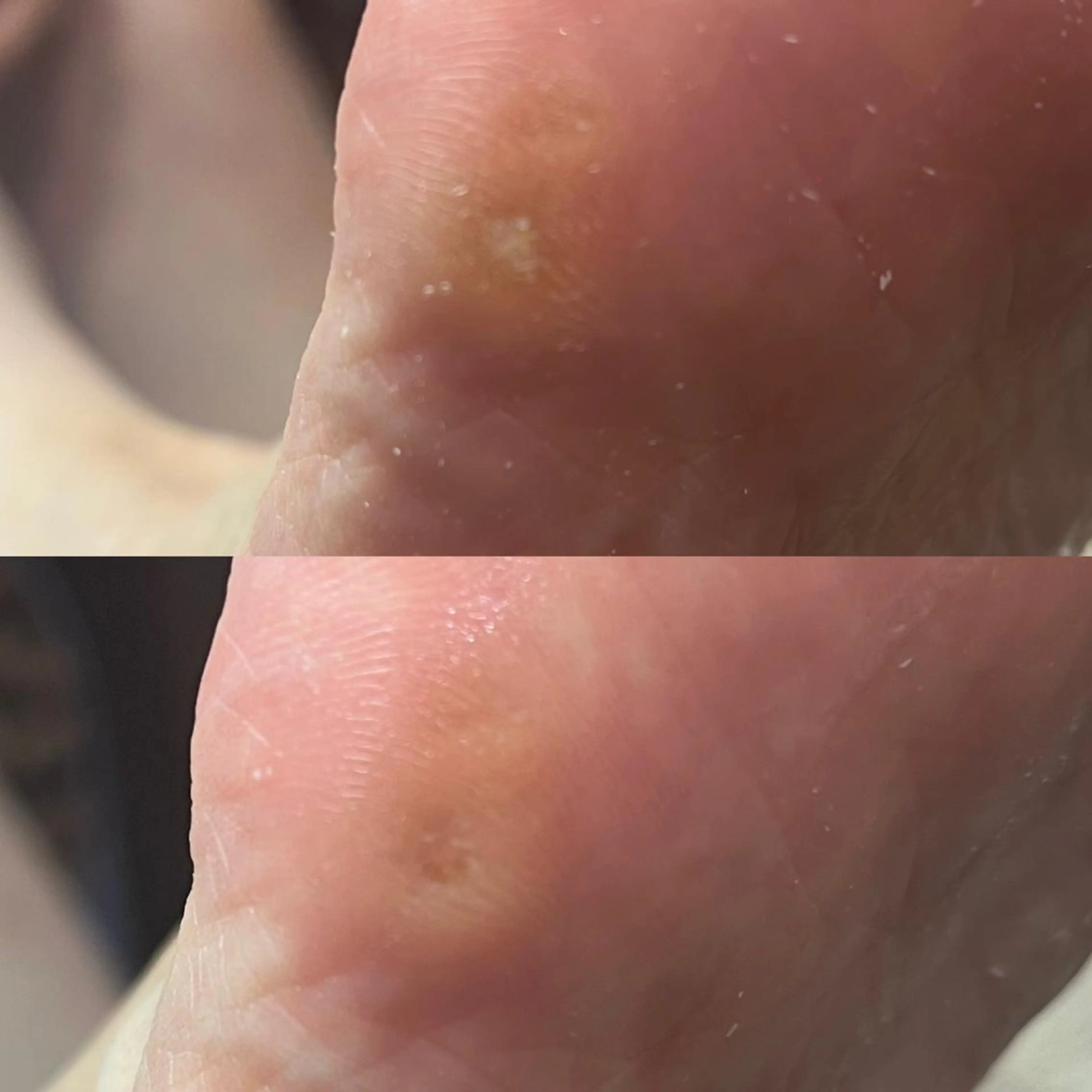 ネイル ジェルネイル パラジェル Cure.美爪育成 salon 岡澤のネイルデザイン