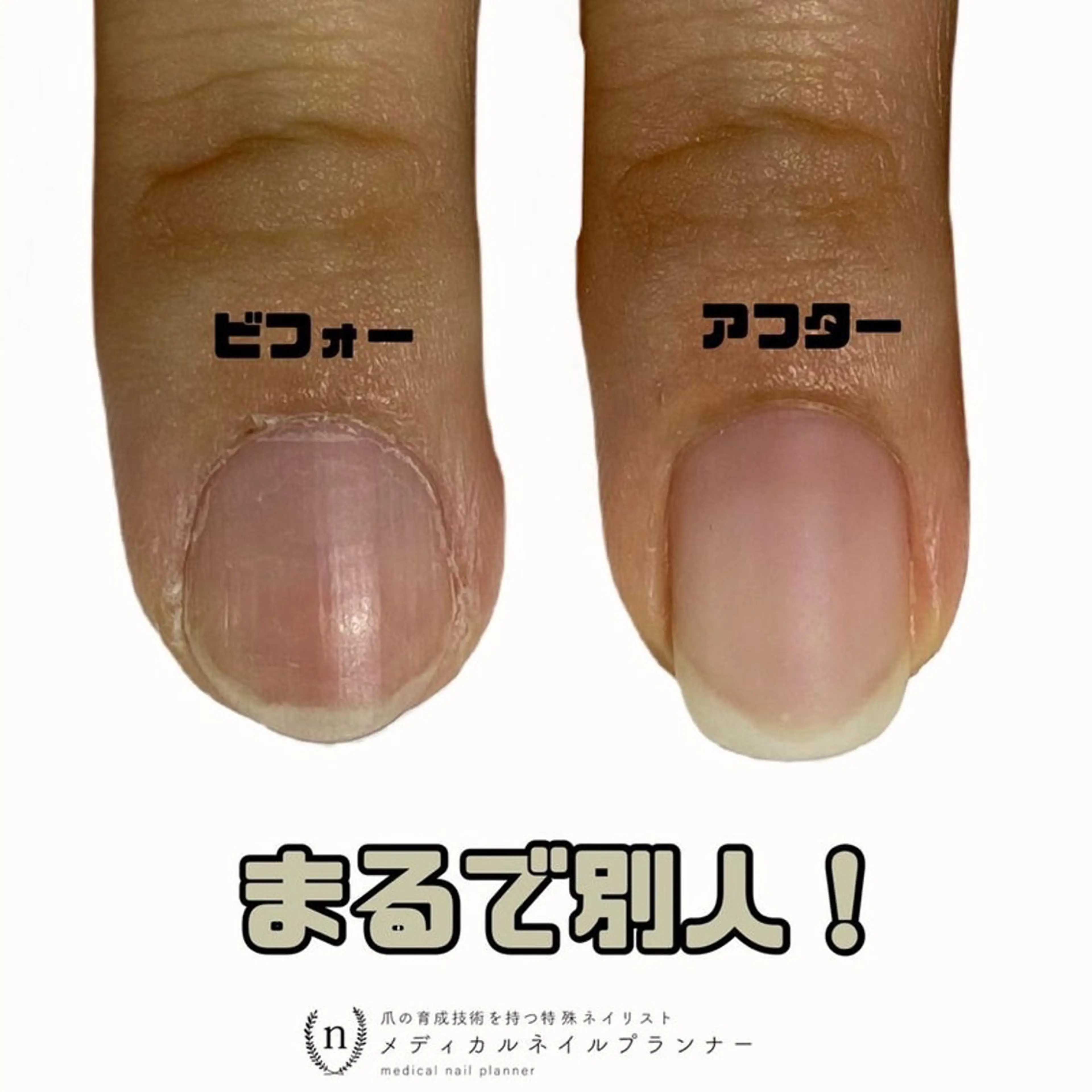 ネイル ハンドネイル ハンドケア tsuki elfのエステ・リラクイメージ