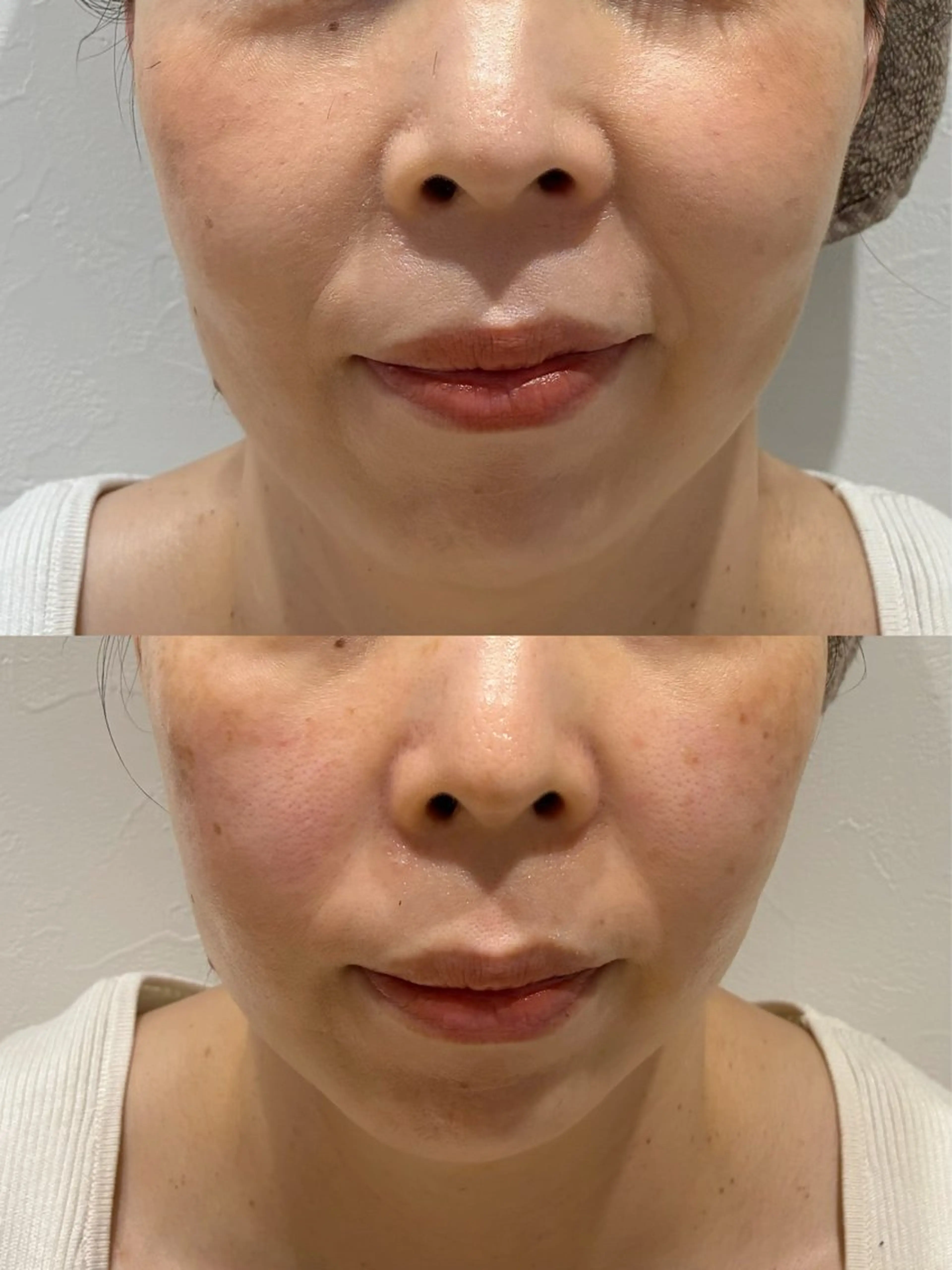 エステ Hair&Spa リーノ所属・折原 あやのエステ・リラクイメージ