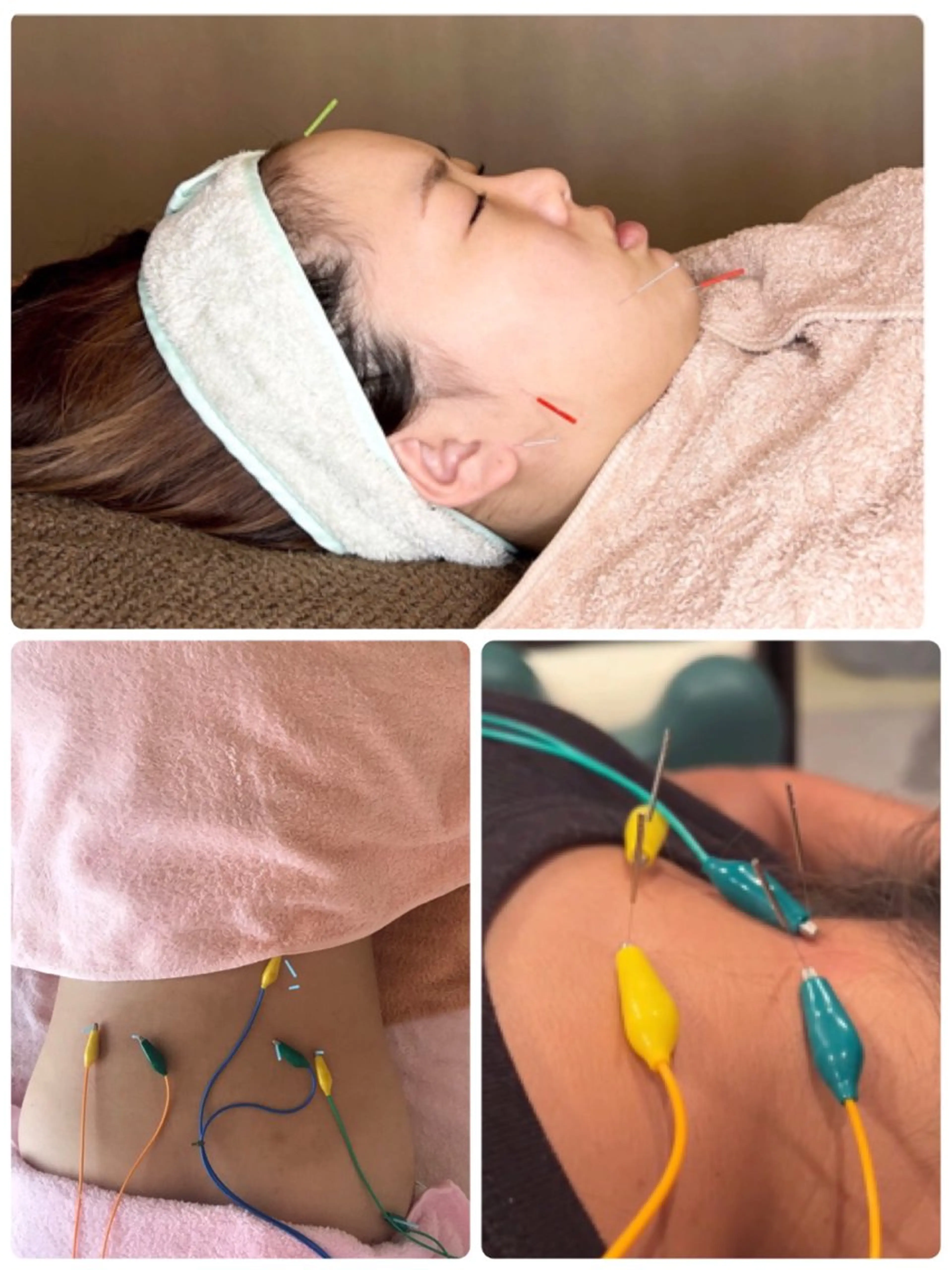 かすがい鍼灸院Re.heart所属・かすがい鍼灸院 Re.heartのエステ・リラクイメージ