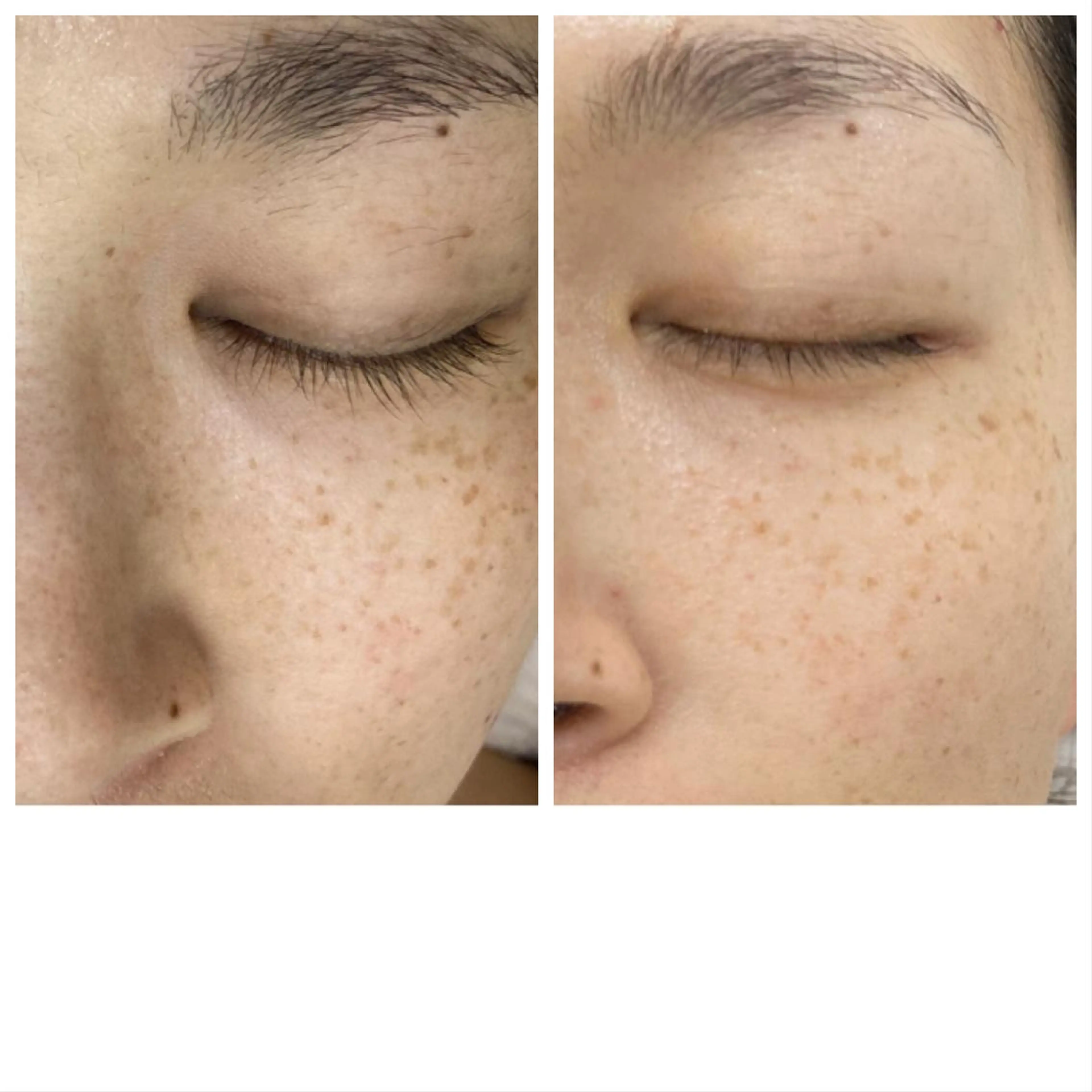 CEサロンblanc bebe所属・高村 有紀のエステ・リラクイメージ