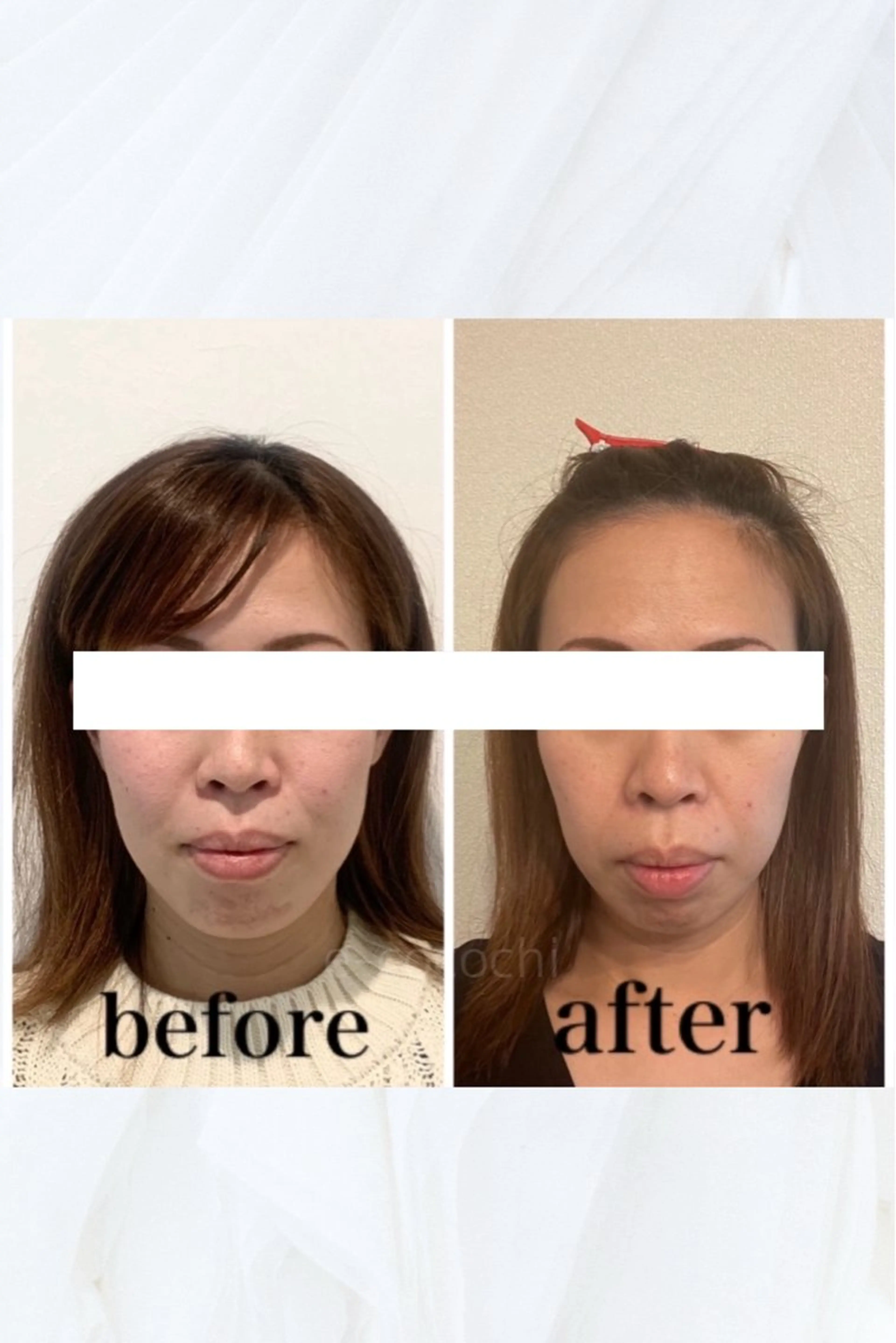 エステ リラク 小顔と ヘッドスパのお店のエステ・リラクイメージ