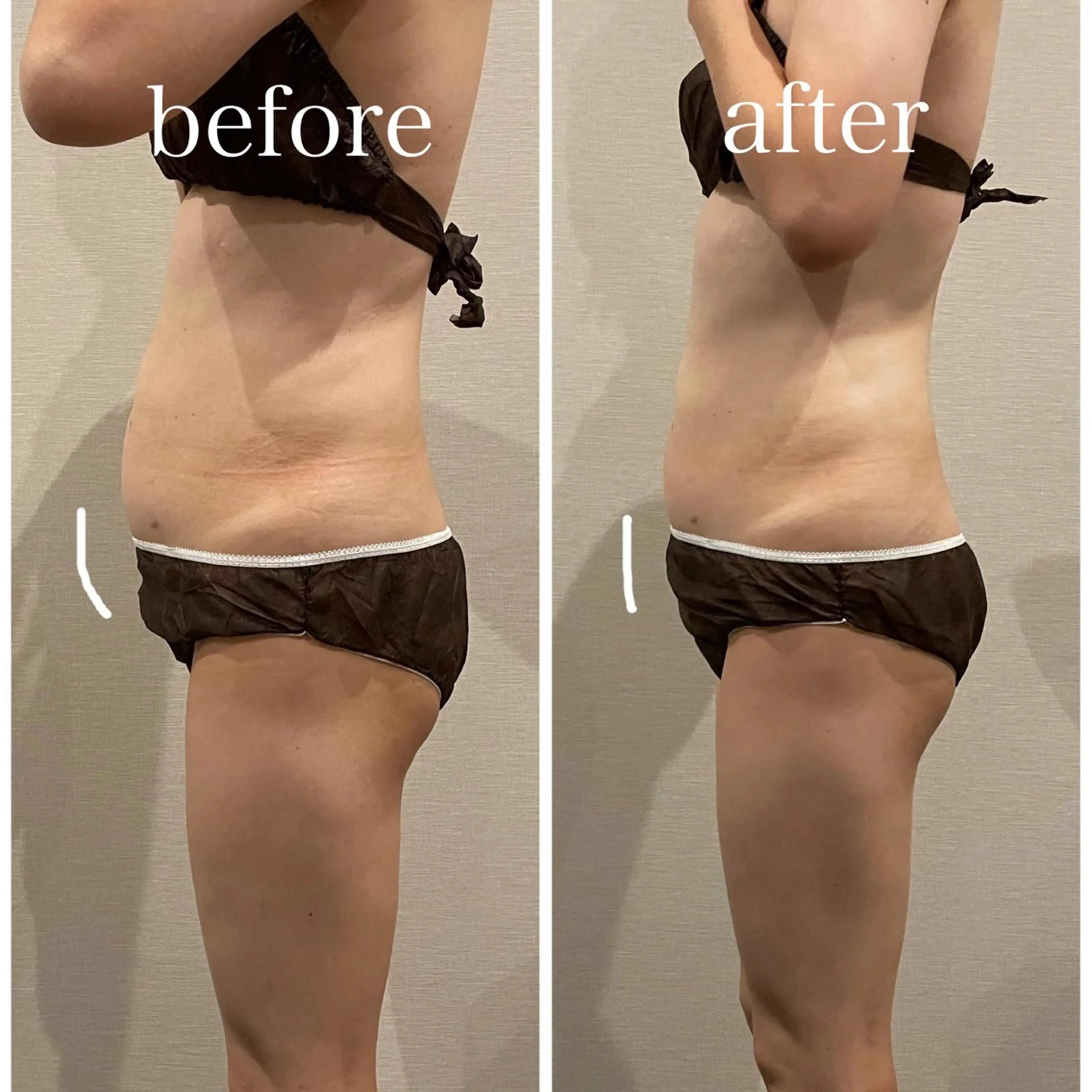 腸もみKalon銀座 オーナーひかるのエステ・リラクイメージ