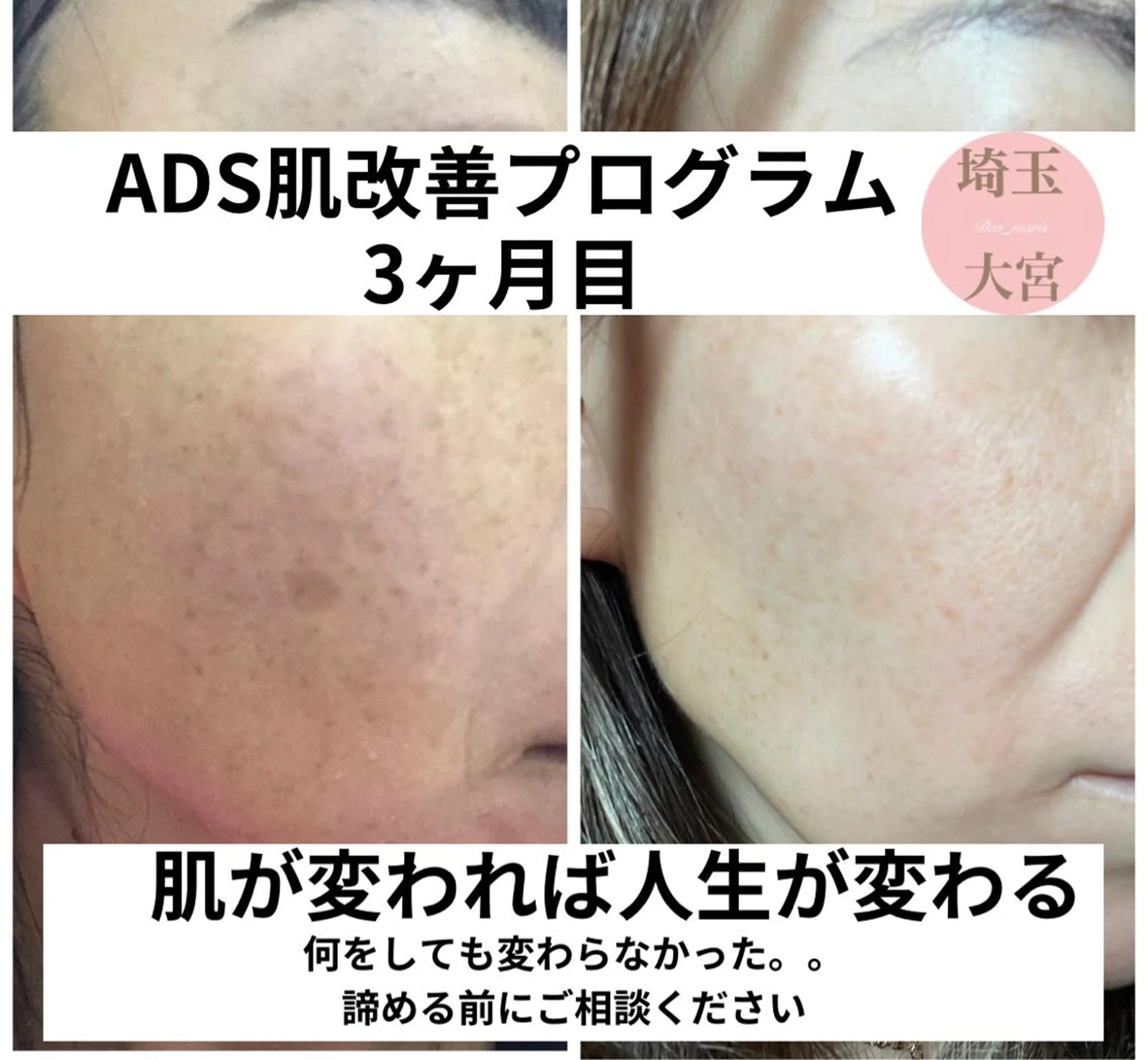 private salon  Dea_maris シュガーリング＆パーソナルボディケア所属・シミ改善・韓国肌管理 ボディメイク痩身のその他イメージ