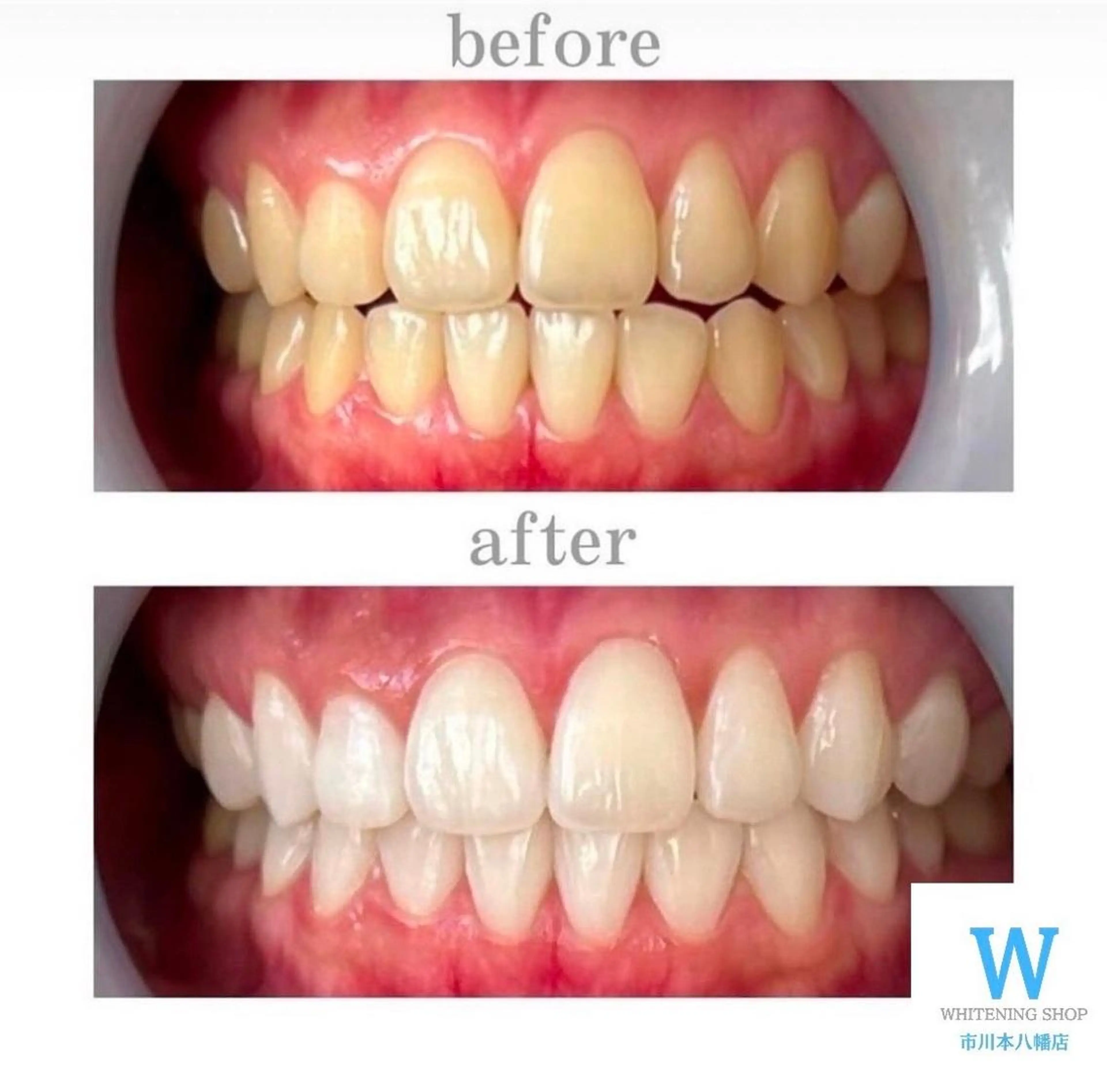 エステ リラク ホワイトニング ショップ本八幡店のエステ・リラクイメージ