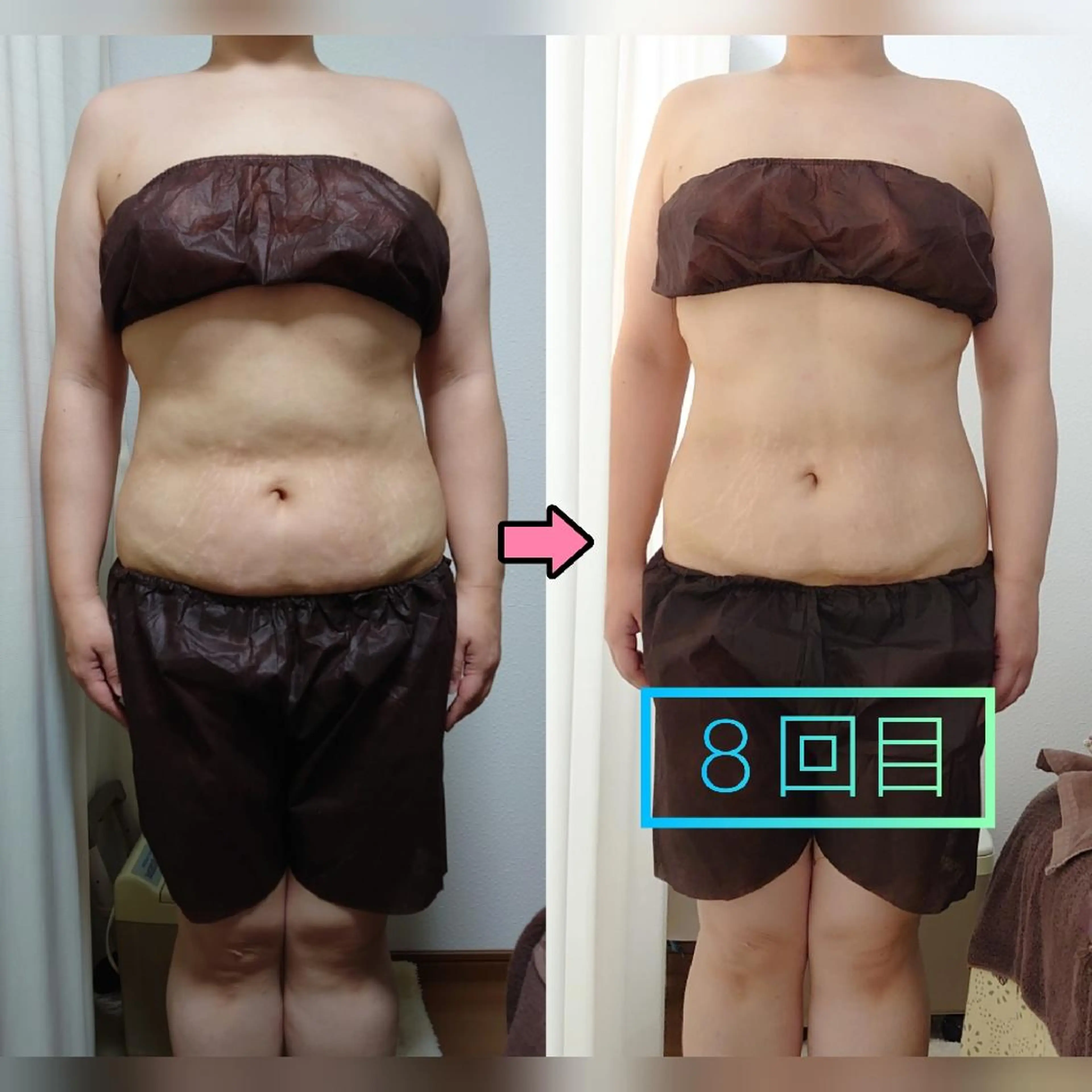 ボディ痩身コースの写真