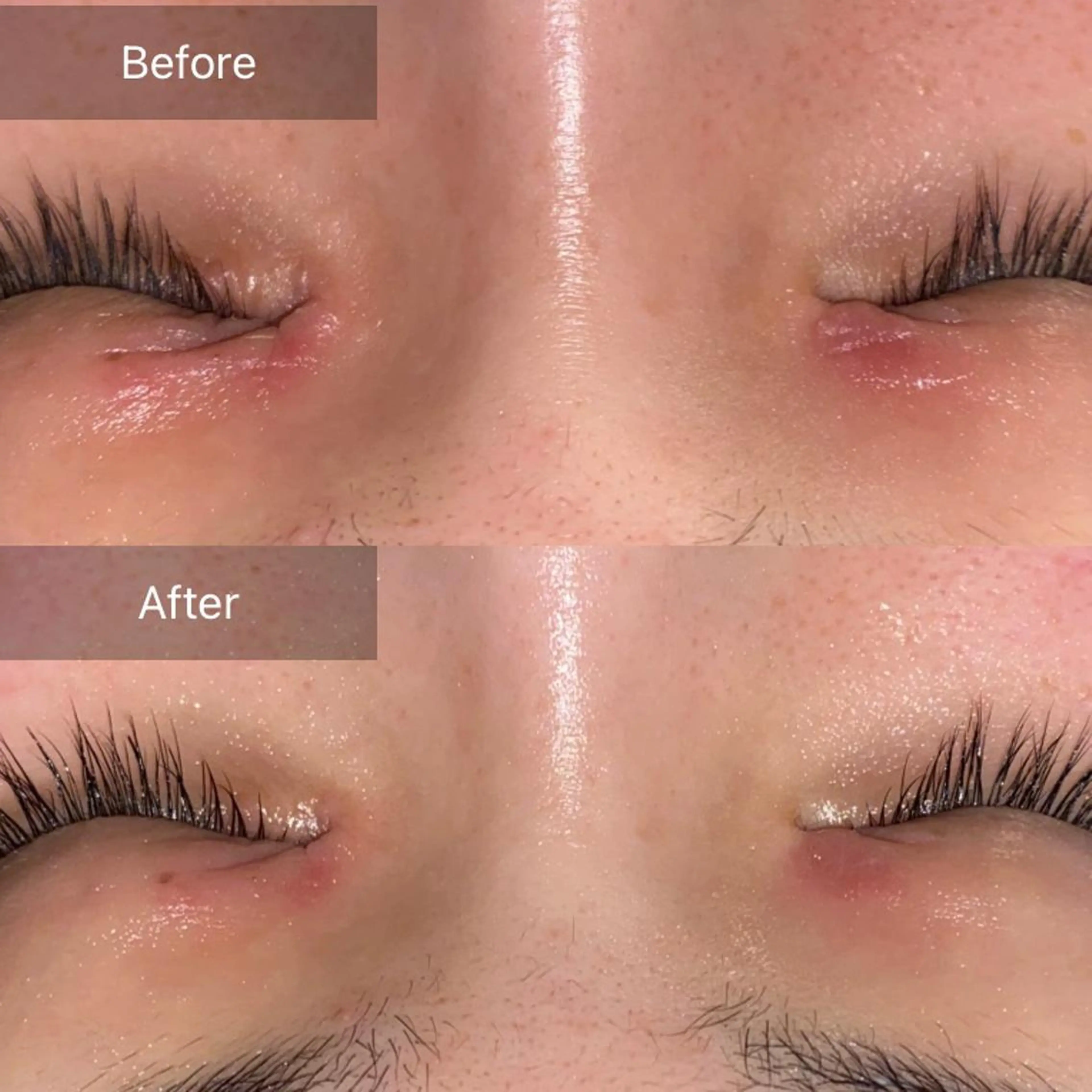 Mandarin Orange所属・毛穴から始める肌メン テマンダリンオレンジのエステ・リラクイメージ