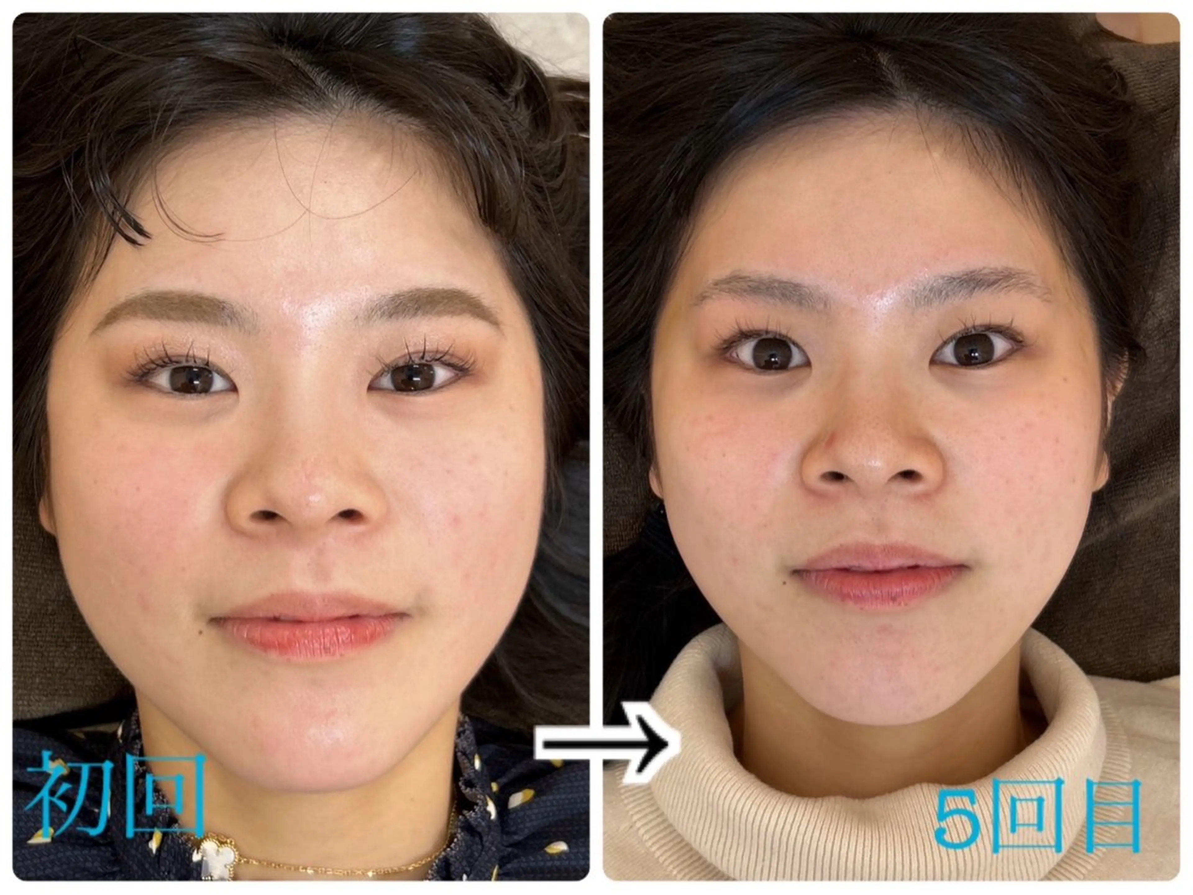 エステ リラク 半蔵門駅前 整体院のエステ・リラクイメージ