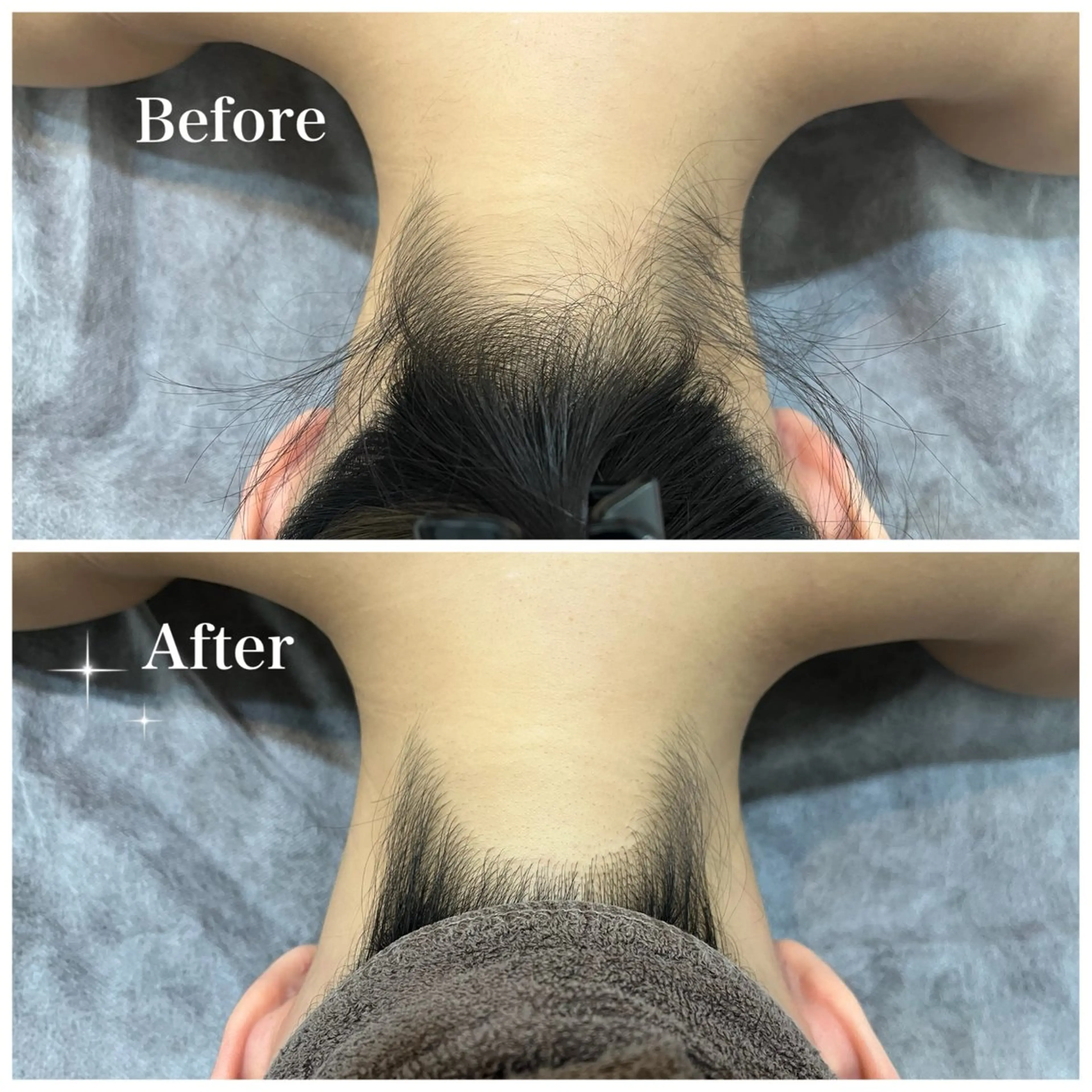 脱毛 脱毛サロン fam.豊澤柚良のエステ・リラクイメージ