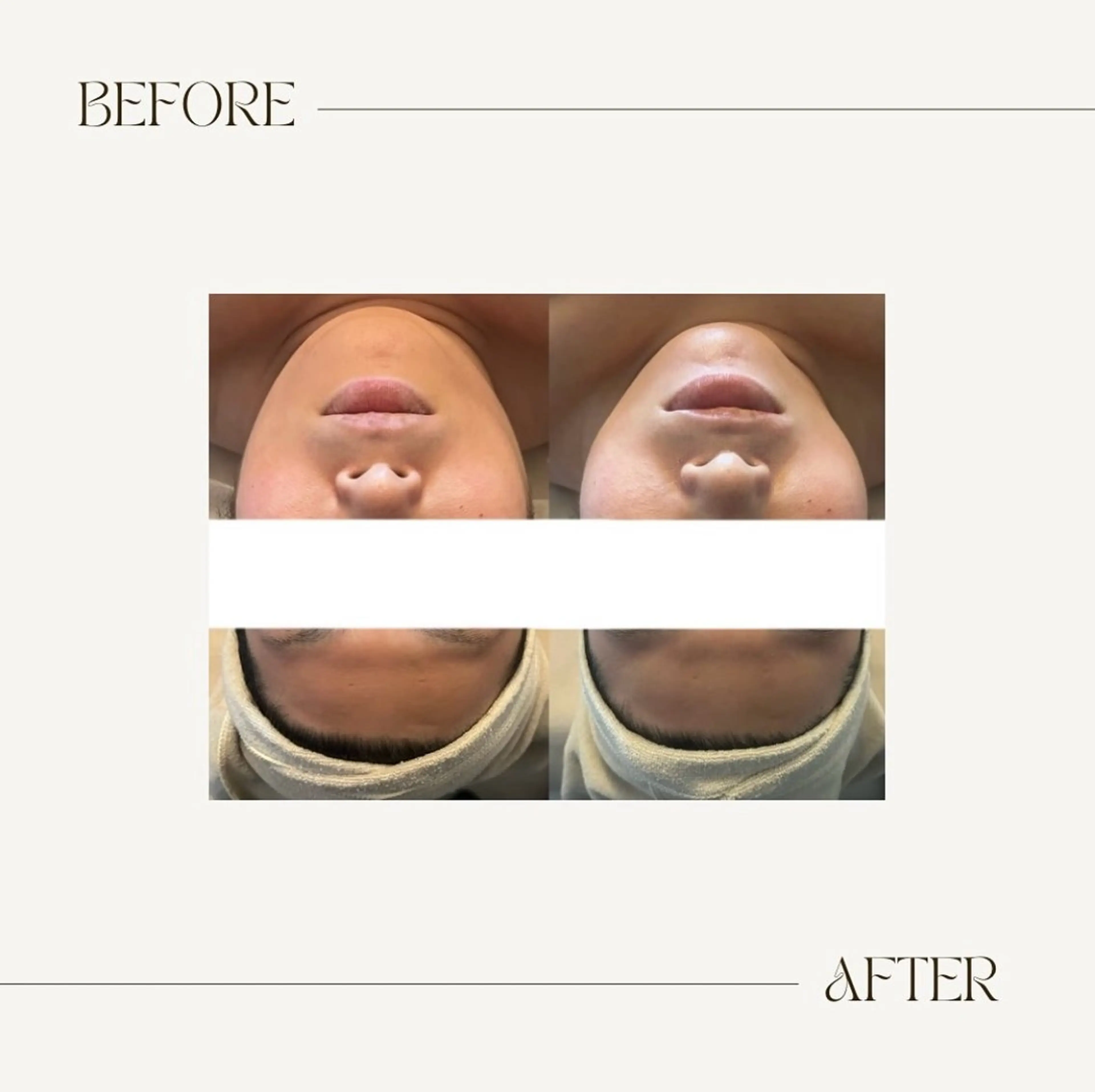 エステ salon Soie所属・salon Soieのエステ・リラクイメージ