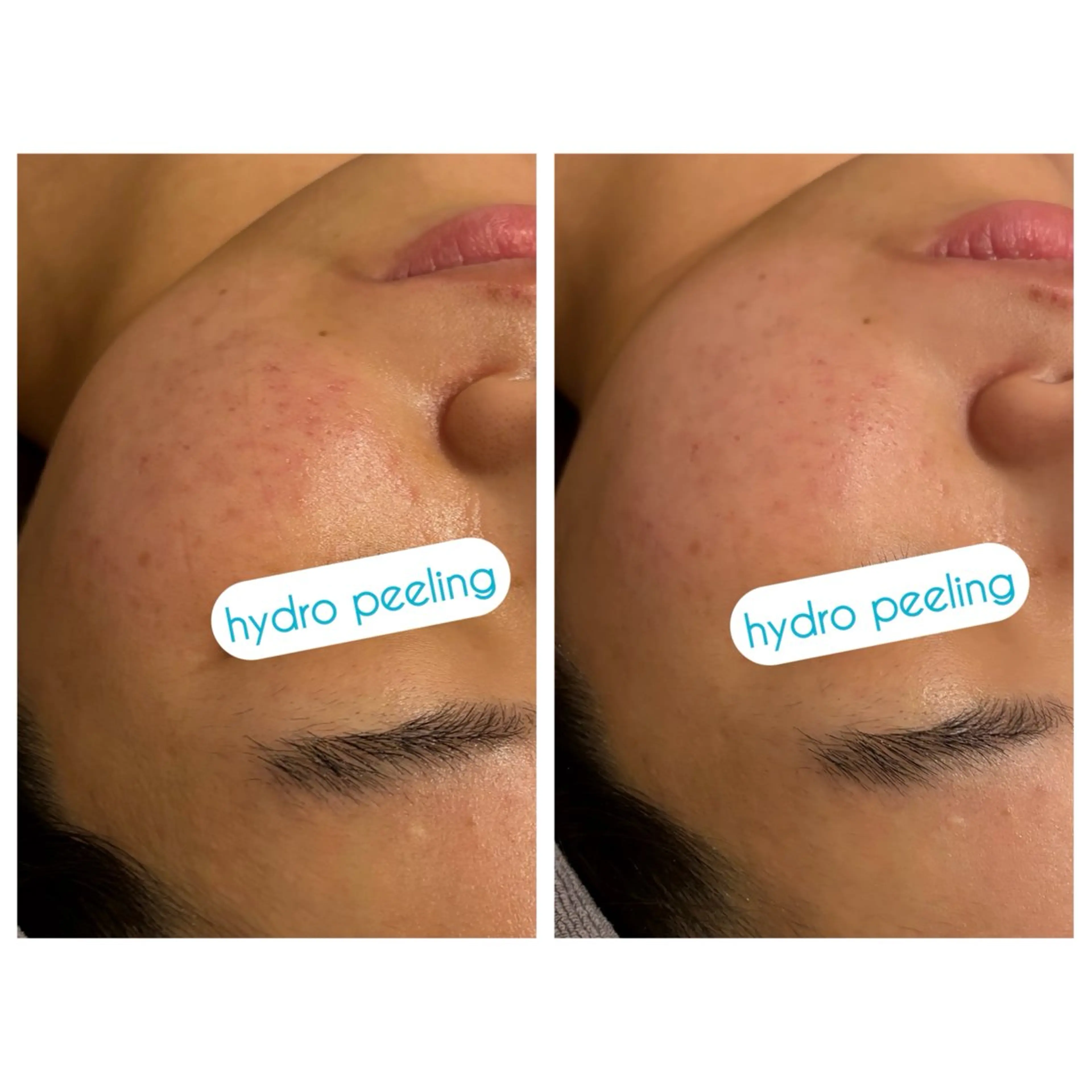 ☆痩身/小顔☆ 結果出します☆のエステ・リラクイメージ