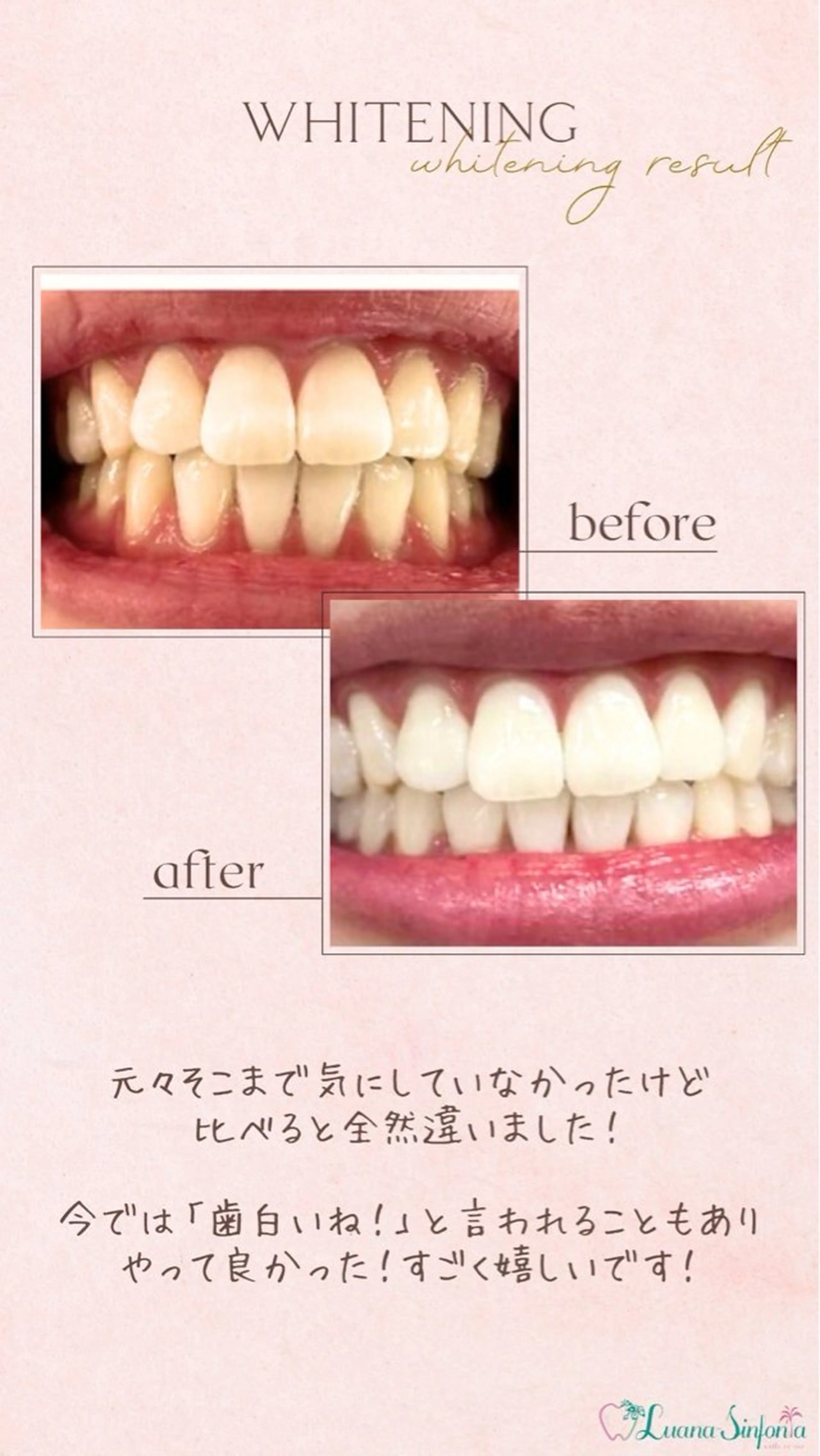 橋口 花菜子のその他イメージ