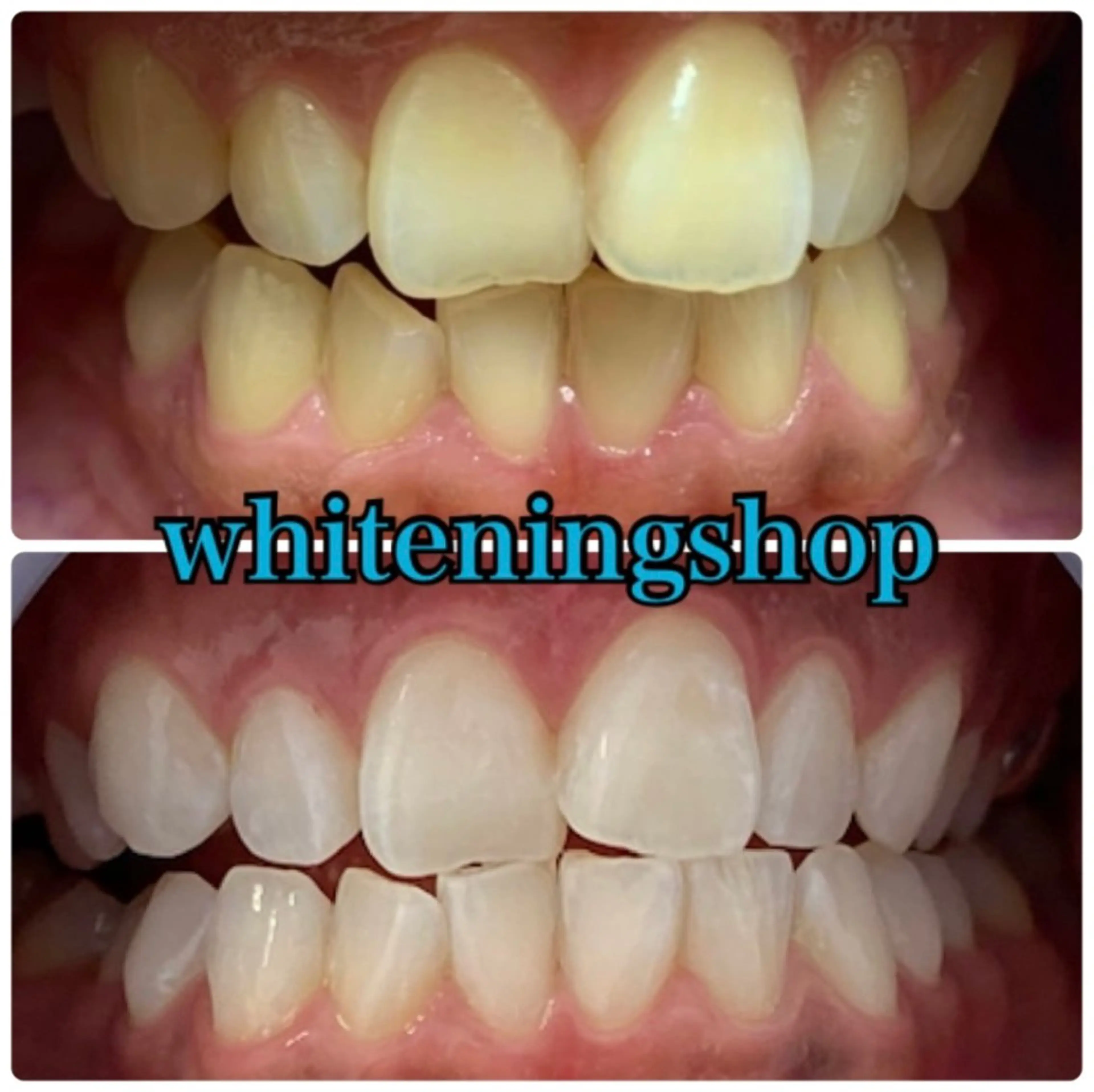 エステ リラク ホワイトニング ショップ吉祥寺店のエステ・リラクイメージ