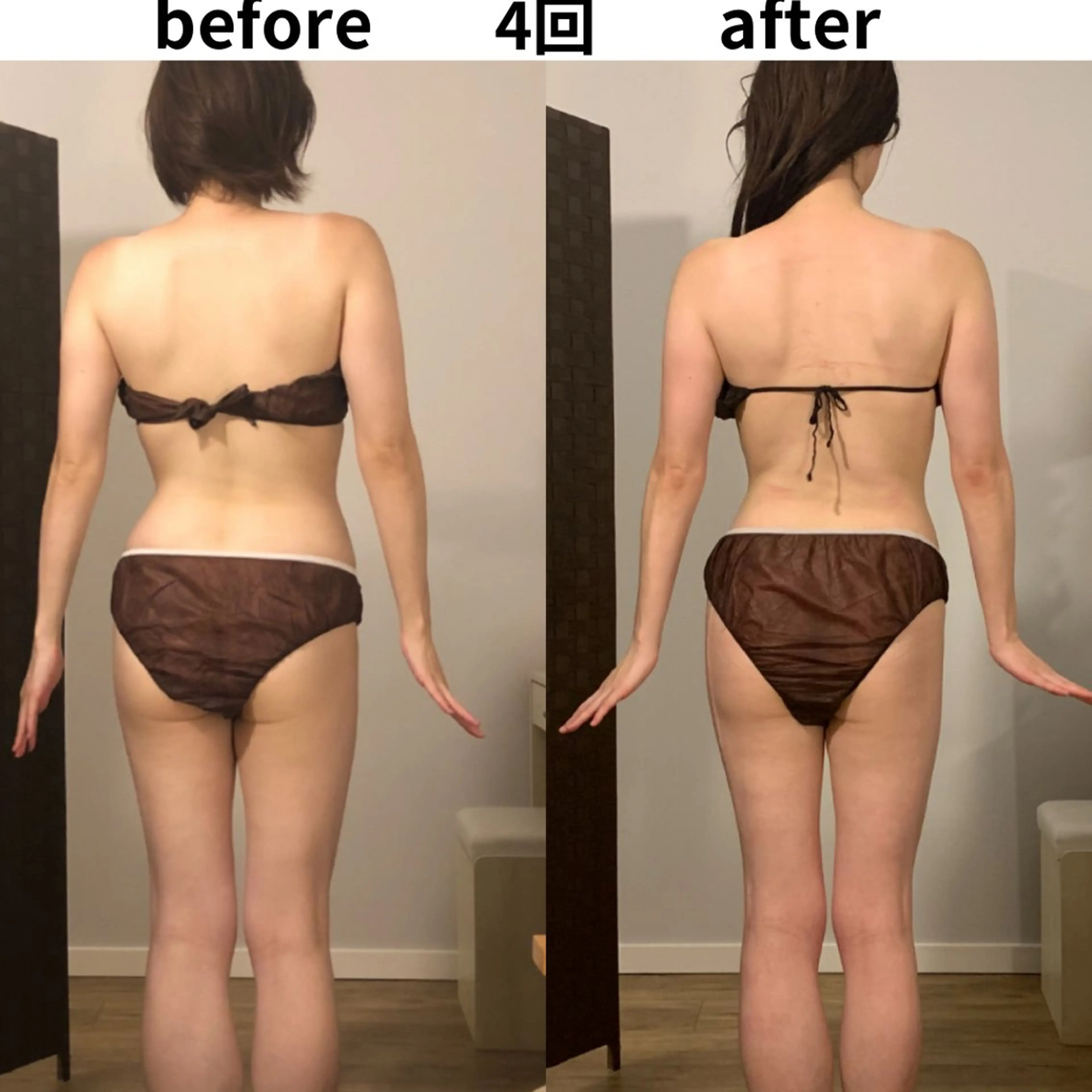 小顔・痩身専門店 Sunao所属・小顔.足痩せ整体 痩身天六Sunaoのその他イメージ