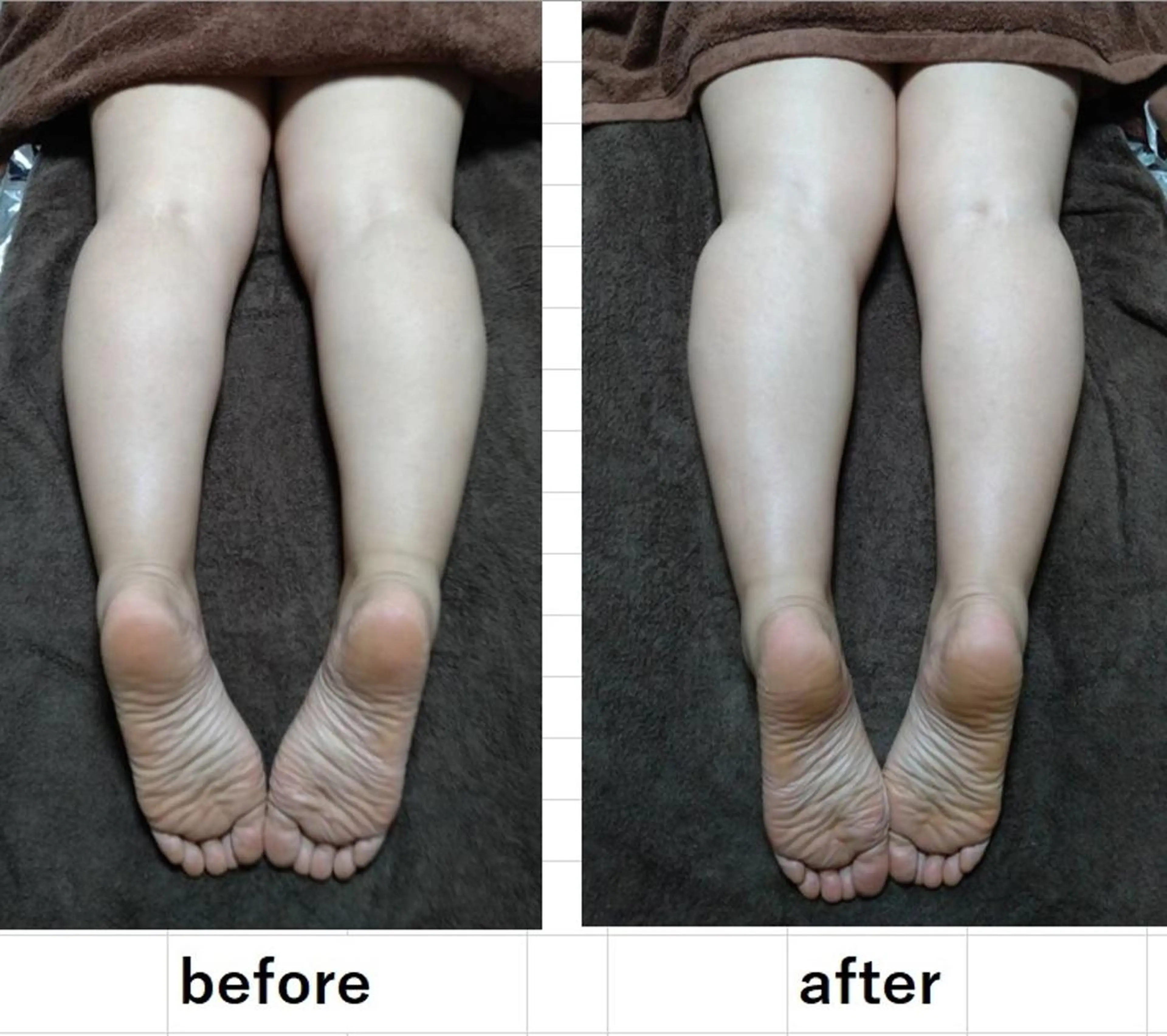 初回限定コース！美脚スッキリ姫素足(むくみ·セルライト·ヒップアップ·など)骨盤調整付きの写真