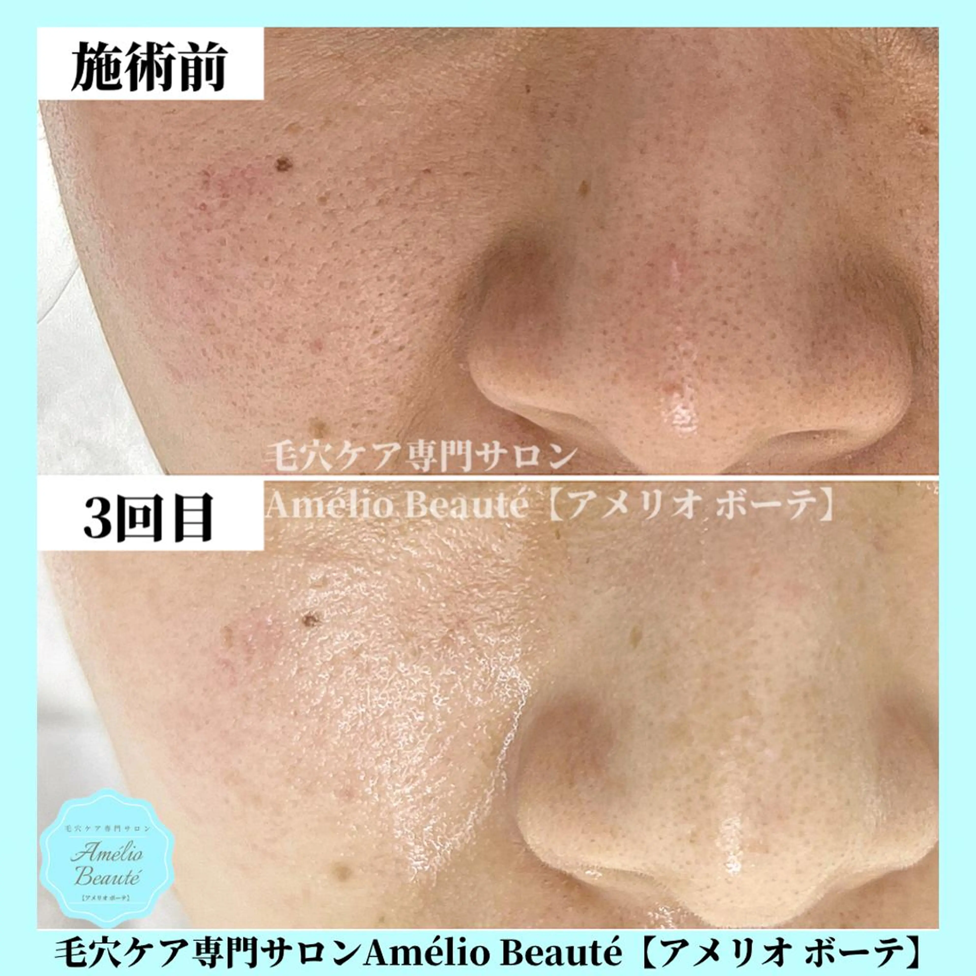 毛穴ケア専門サロン Amélio Beauté所属・毛穴ケア専門サロン アメリオボーテのその他イメージ