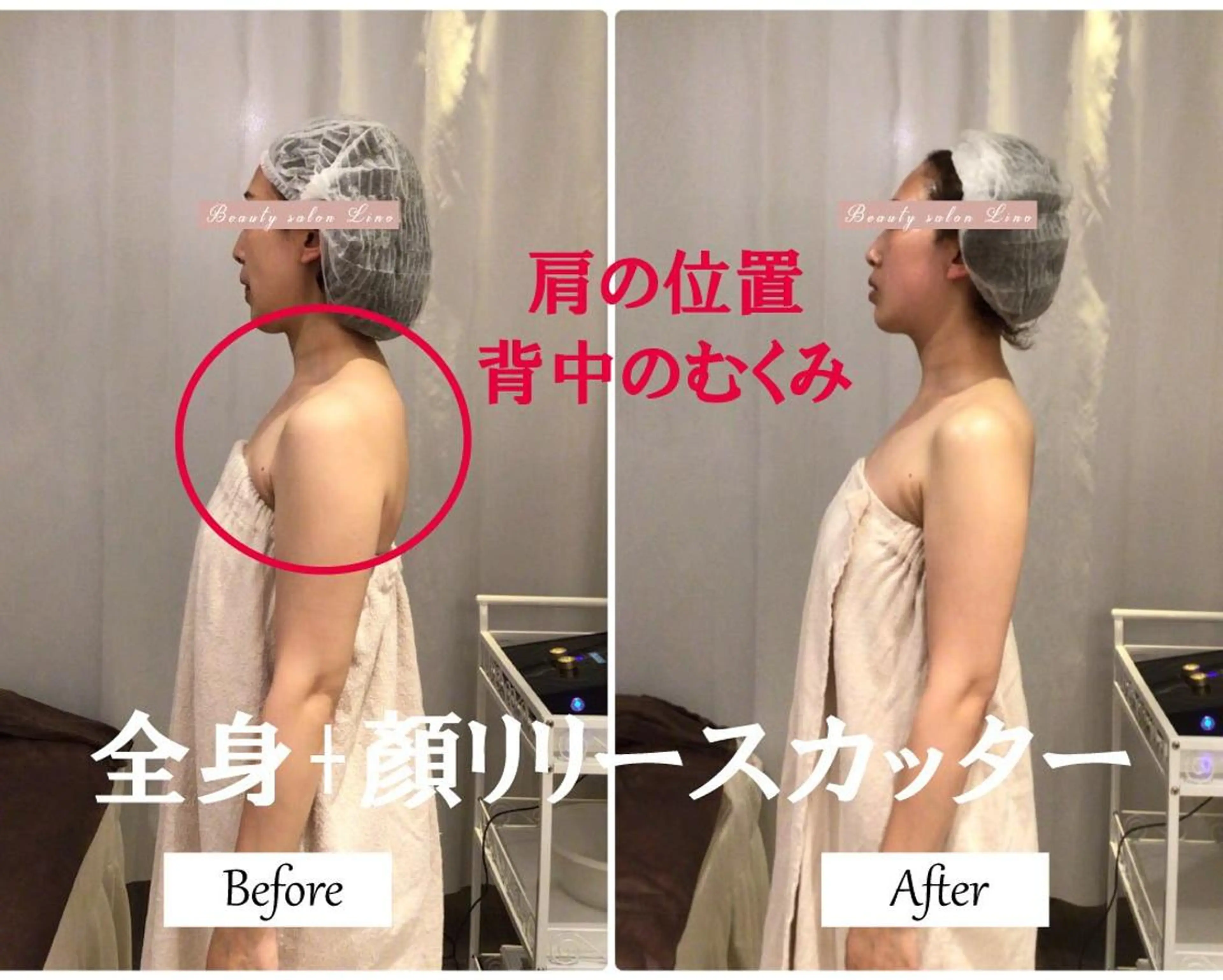 ブライダルサロン |Lino【堀江】のエステ・リラクイメージ