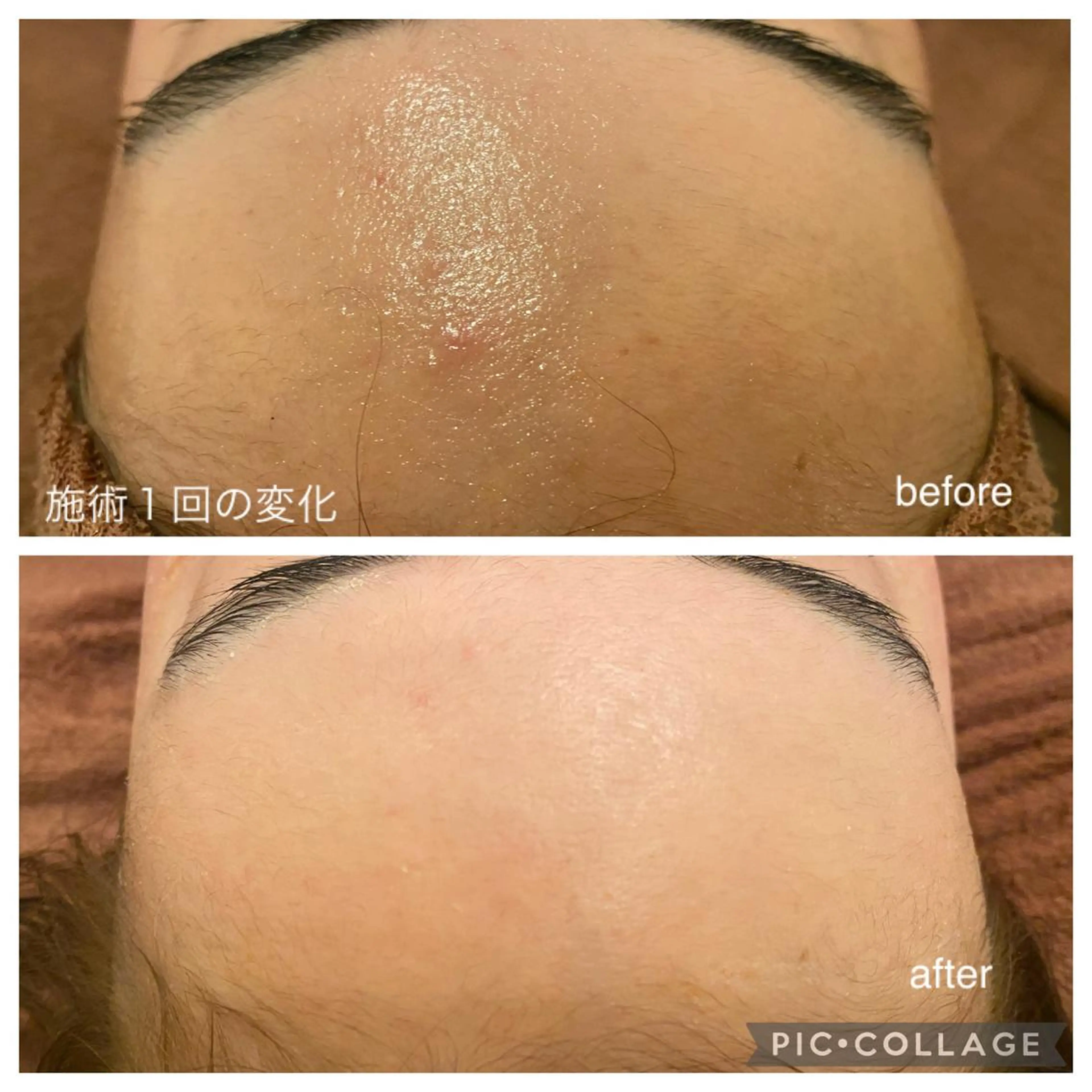 夏までに肌荒れ卒業 するサロン🌻のエステ・リラクイメージ