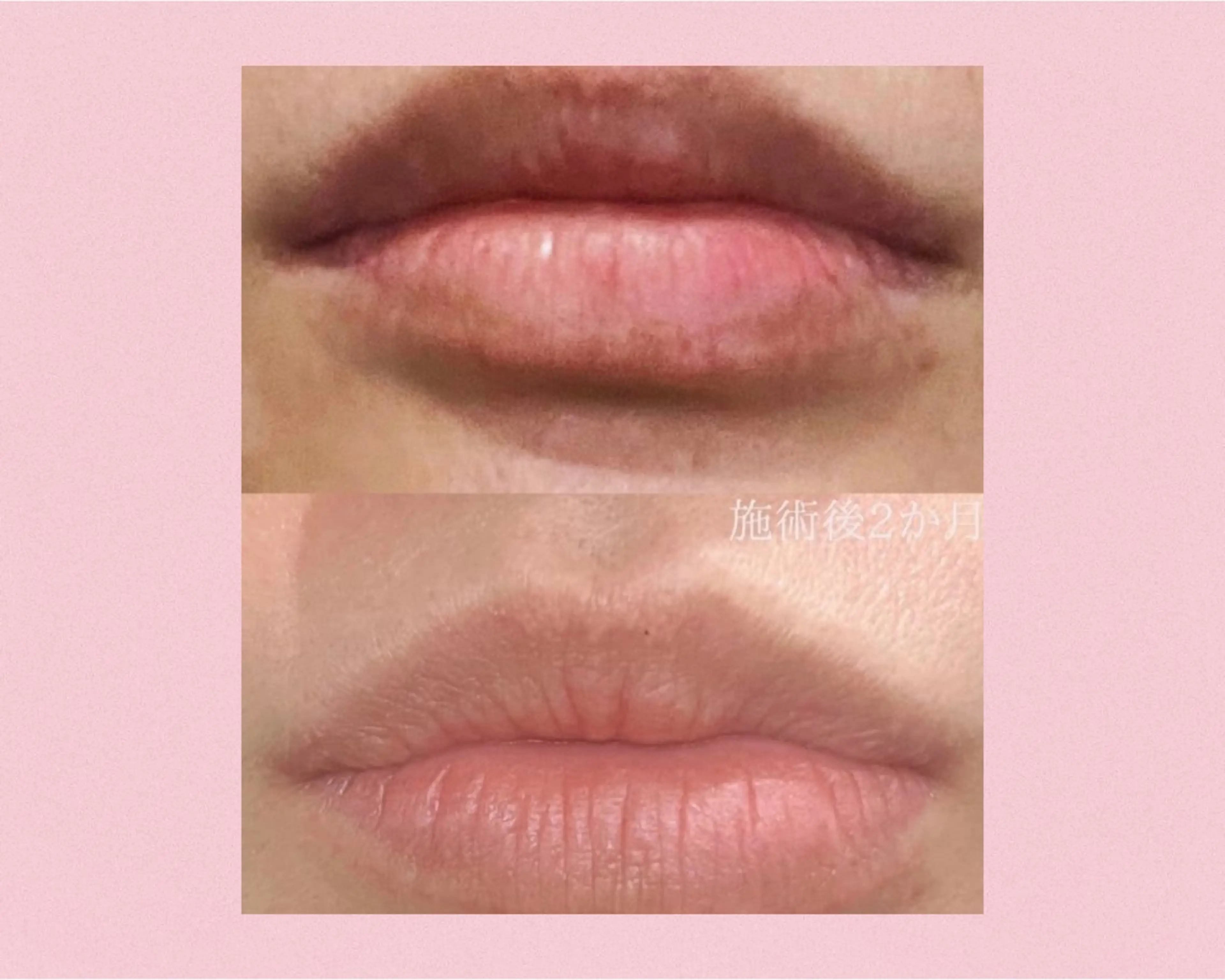 ELEGANCE所属・メンズ脱毛サロン BRIGHTのエステ・リラクイメージ